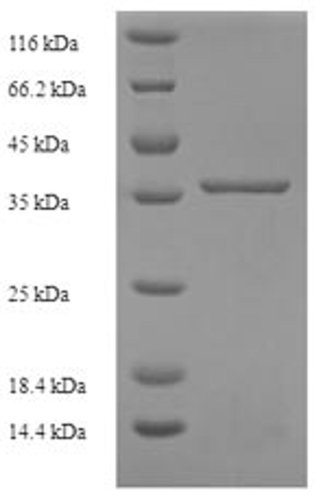 (Tris-Glycine gel) Discontinuous SDS-PAGE (reduced) with 5% enrichment gel and 15% separation gel.