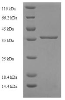 (Tris-Glycine gel) Discontinuous SDS-PAGE (reduced) with 5% enrichment gel and 15% separation gel.