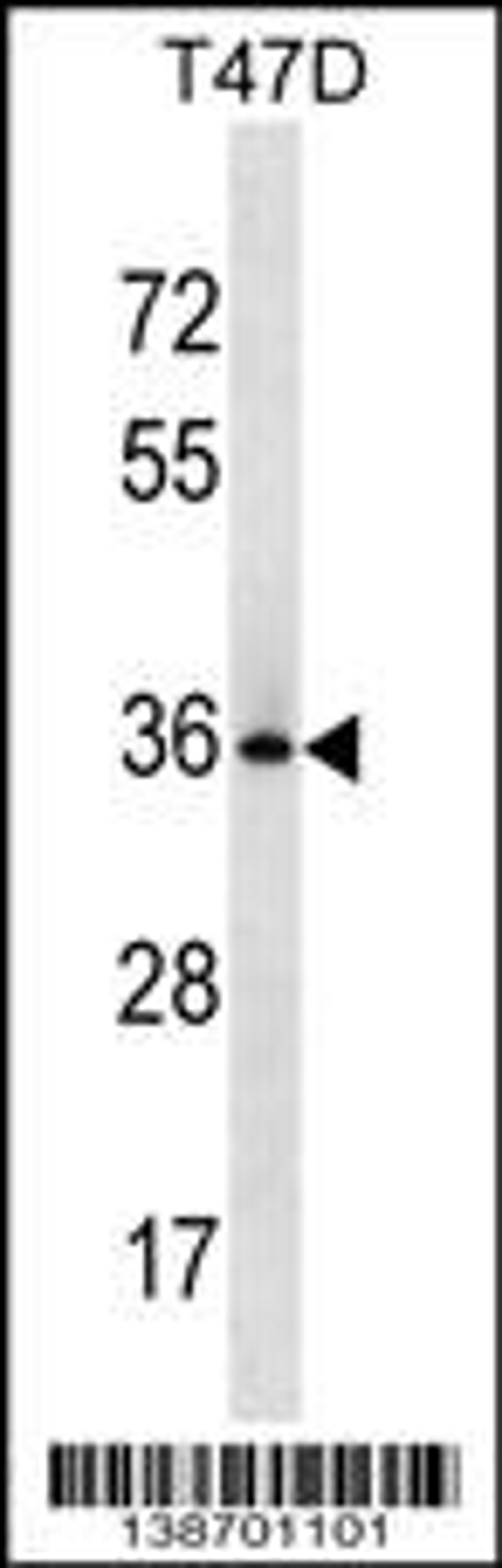 Western blot analysis in T47D cell line lysates (35ug/lane).