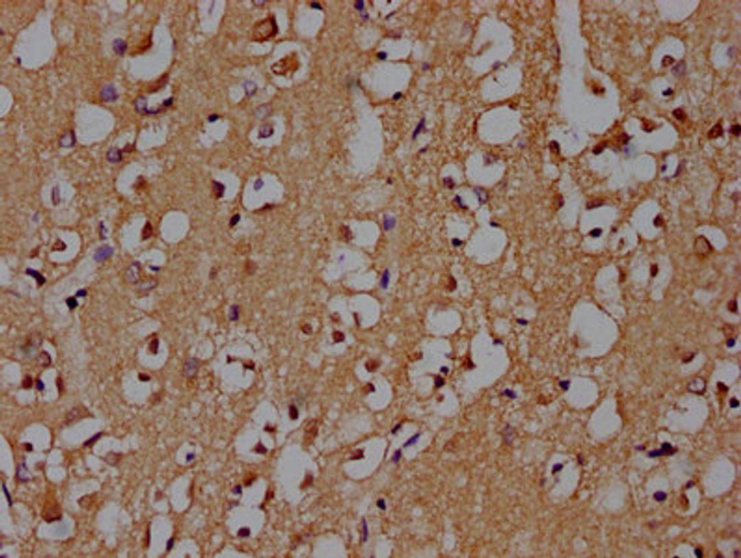 IHC image of CSB-PA021912OA01HU diluted at 1:100 and staining in paraffin-embedded human brain tissue performed on a Leica BondTM system. After dewaxing and hydration, antigen retrieval was mediated by high pressure in a citrate buffer (pH 6.0). Section was blocked with 10% normal goat serum 30min at RT. Then primary antibody (1% BSA) was incubated at 4°C overnight. The primary is detected by a biotinylated secondary antibody and visualized using an HRP conjugated SP system.