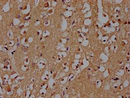 IHC image of CSB-PA021912OA01HU diluted at 1:100 and staining in paraffin-embedded human brain tissue performed on a Leica BondTM system. After dewaxing and hydration, antigen retrieval was mediated by high pressure in a citrate buffer (pH 6.0). Section was blocked with 10% normal goat serum 30min at RT. Then primary antibody (1% BSA) was incubated at 4°C overnight. The primary is detected by a biotinylated secondary antibody and visualized using an HRP conjugated SP system.