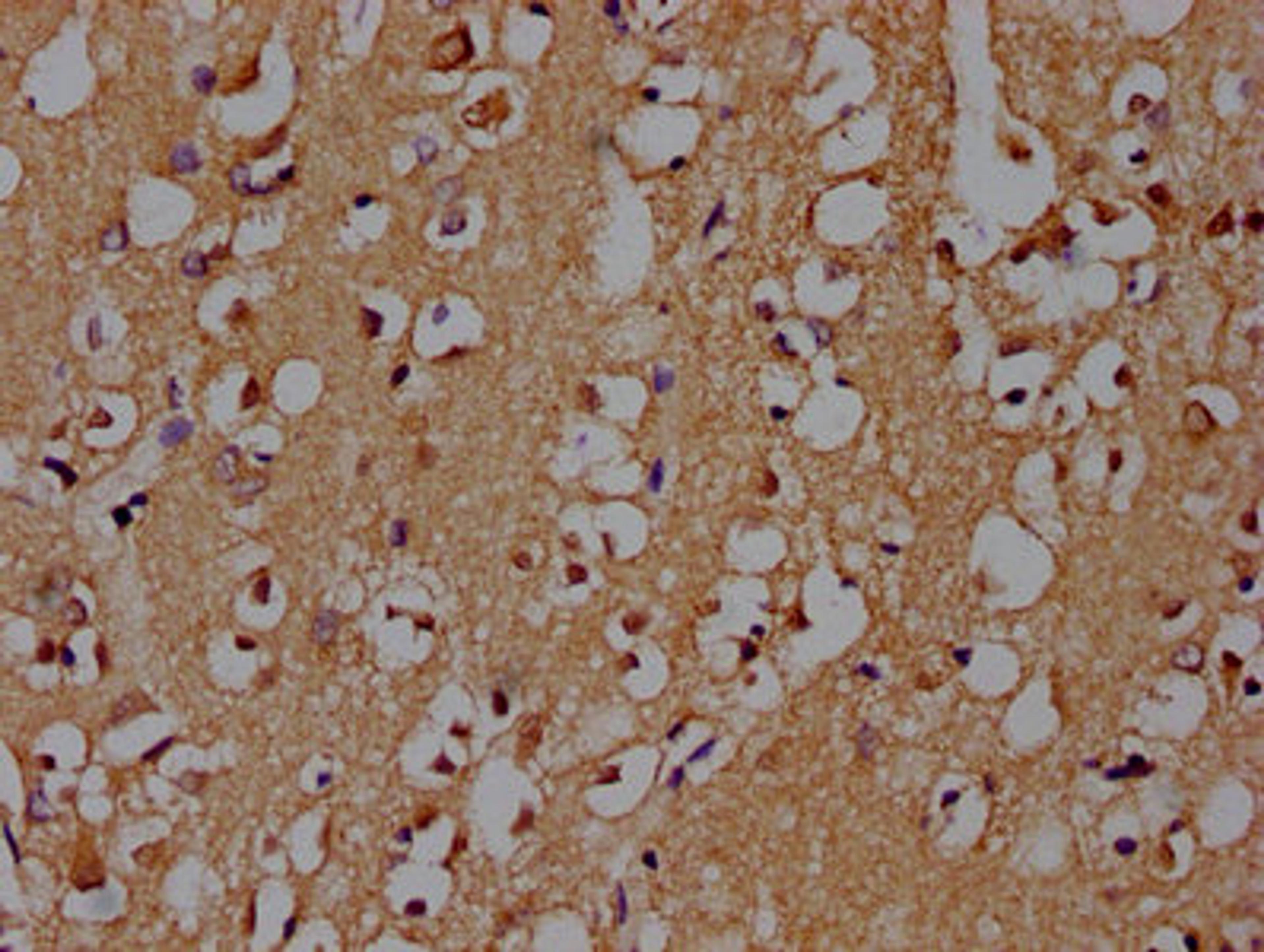 IHC image of CSB-PA021912OA01HU diluted at 1:100 and staining in paraffin-embedded human brain tissue performed on a Leica BondTM system. After dewaxing and hydration, antigen retrieval was mediated by high pressure in a citrate buffer (pH 6.0). Section was blocked with 10% normal goat serum 30min at RT. Then primary antibody (1% BSA) was incubated at 4°C overnight. The primary is detected by a biotinylated secondary antibody and visualized using an HRP conjugated SP system.