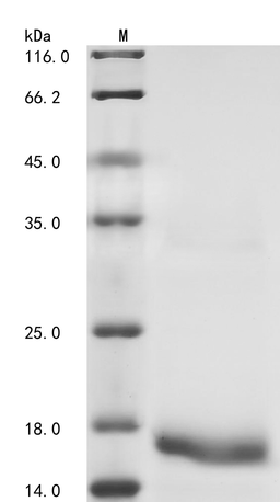 (Tris-Glycine gel) Discontinuous SDS-PAGE (reduced) with 5% enrichment gel and 15% separation gel.
