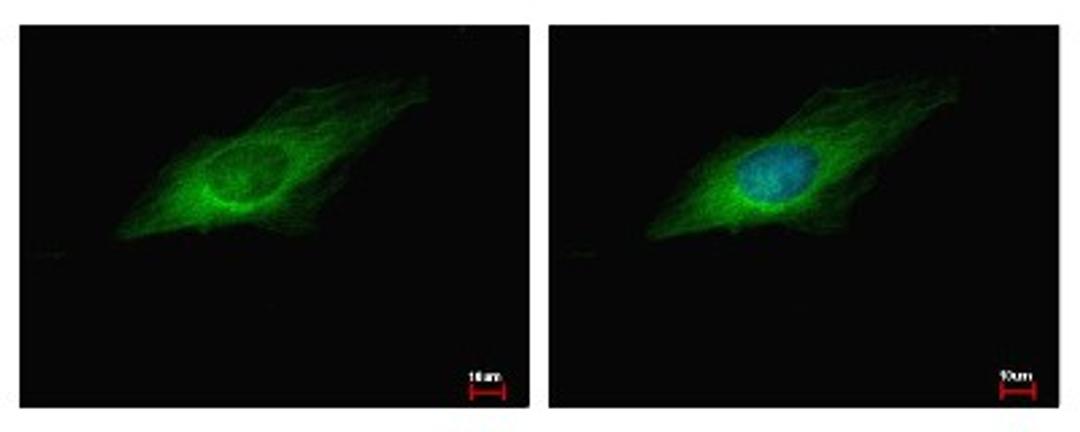 Immunocytochemistry/Immunofluorescence: GEF-H1 Antibody [NBP2-21577] - HeLa cells were fixed in -20C 100% MeOH for 5 min. Green: ARHGEF2 protein stained by GEF-H1 antibody diluted at 1:500. Blue: Hoechst 33343 staining.