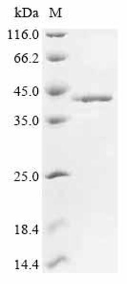 (Tris-Glycine gel) Discontinuous SDS-PAGE (reduced) with 5% enrichment gel and 15% separation gel.