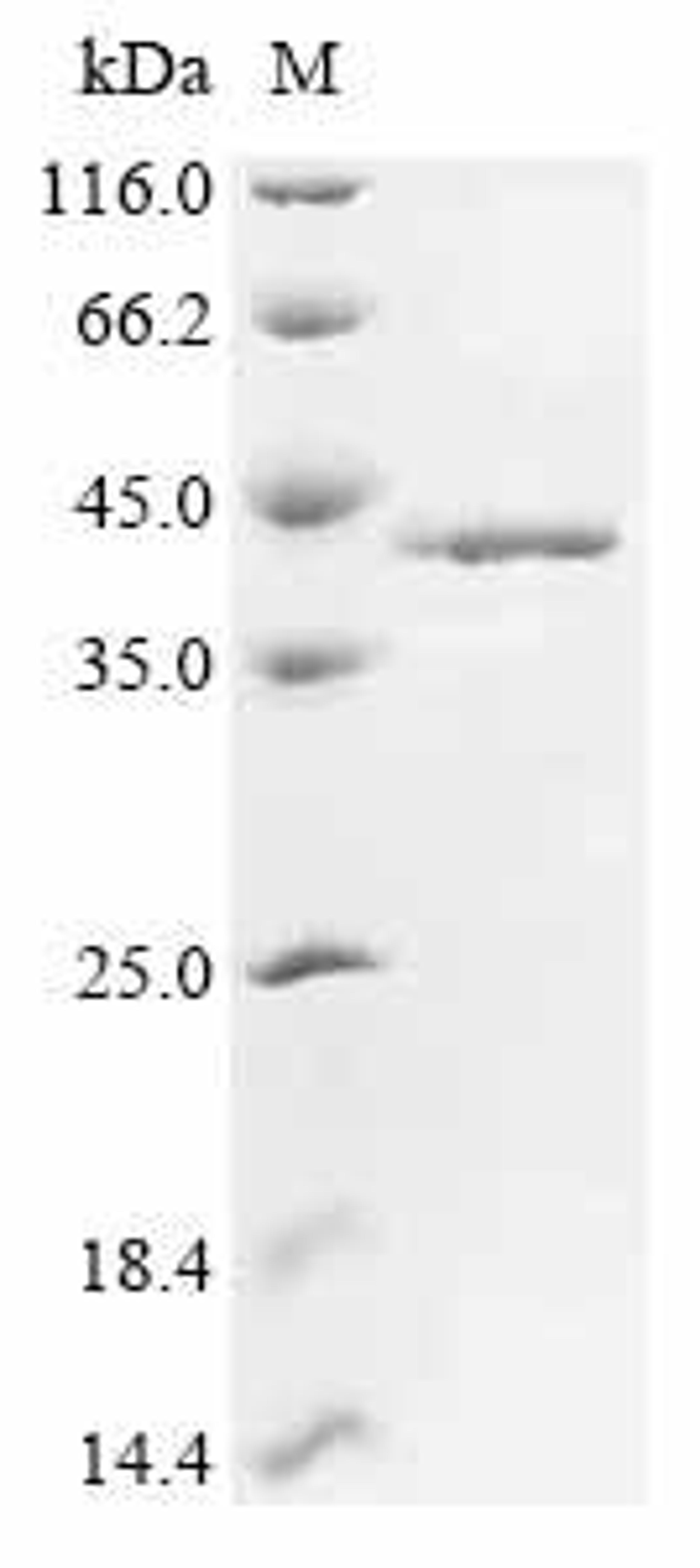 (Tris-Glycine gel) Discontinuous SDS-PAGE (reduced) with 5% enrichment gel and 15% separation gel.