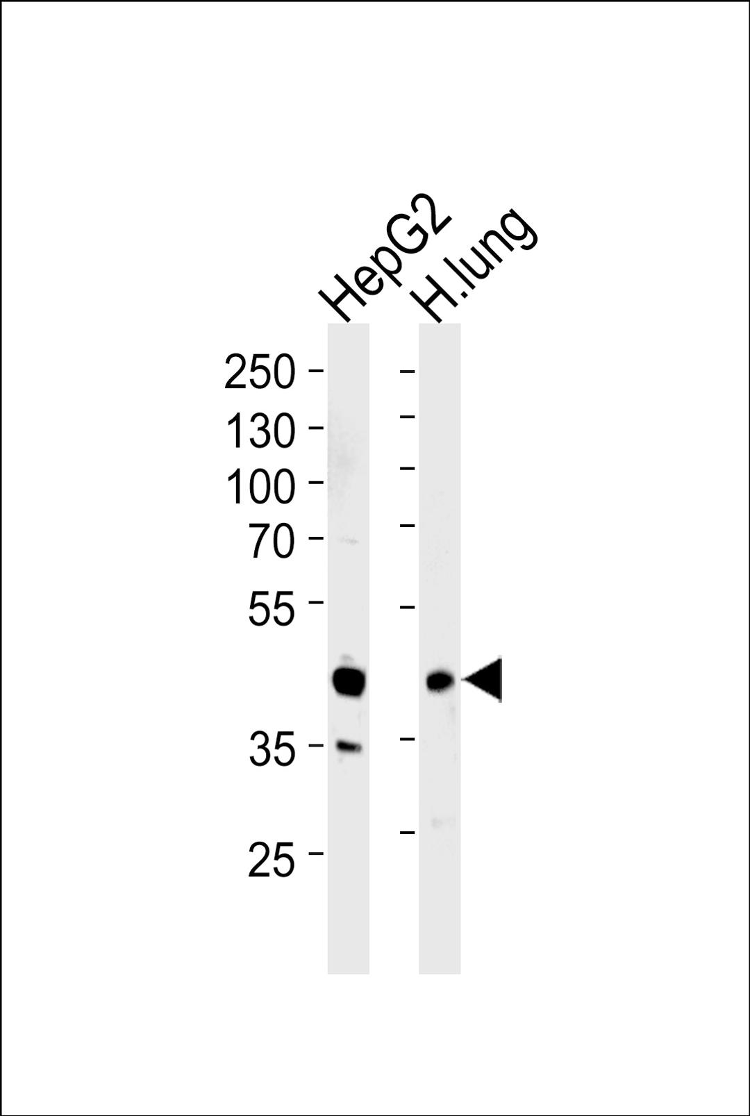 Western blot analysis of lysates from HepG2 cell line and human lung tissue lysates (from left to right), using RAGE Antibody at 1:1000 at each lane.