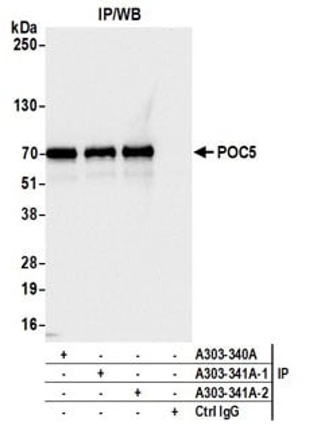 Detection of human POC5 by western blot of immunoprecipitates.