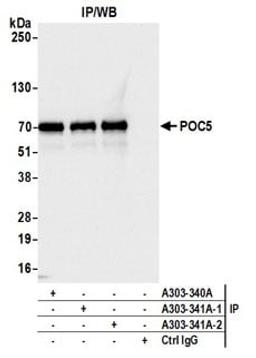 Detection of human POC5 by western blot of immunoprecipitates.