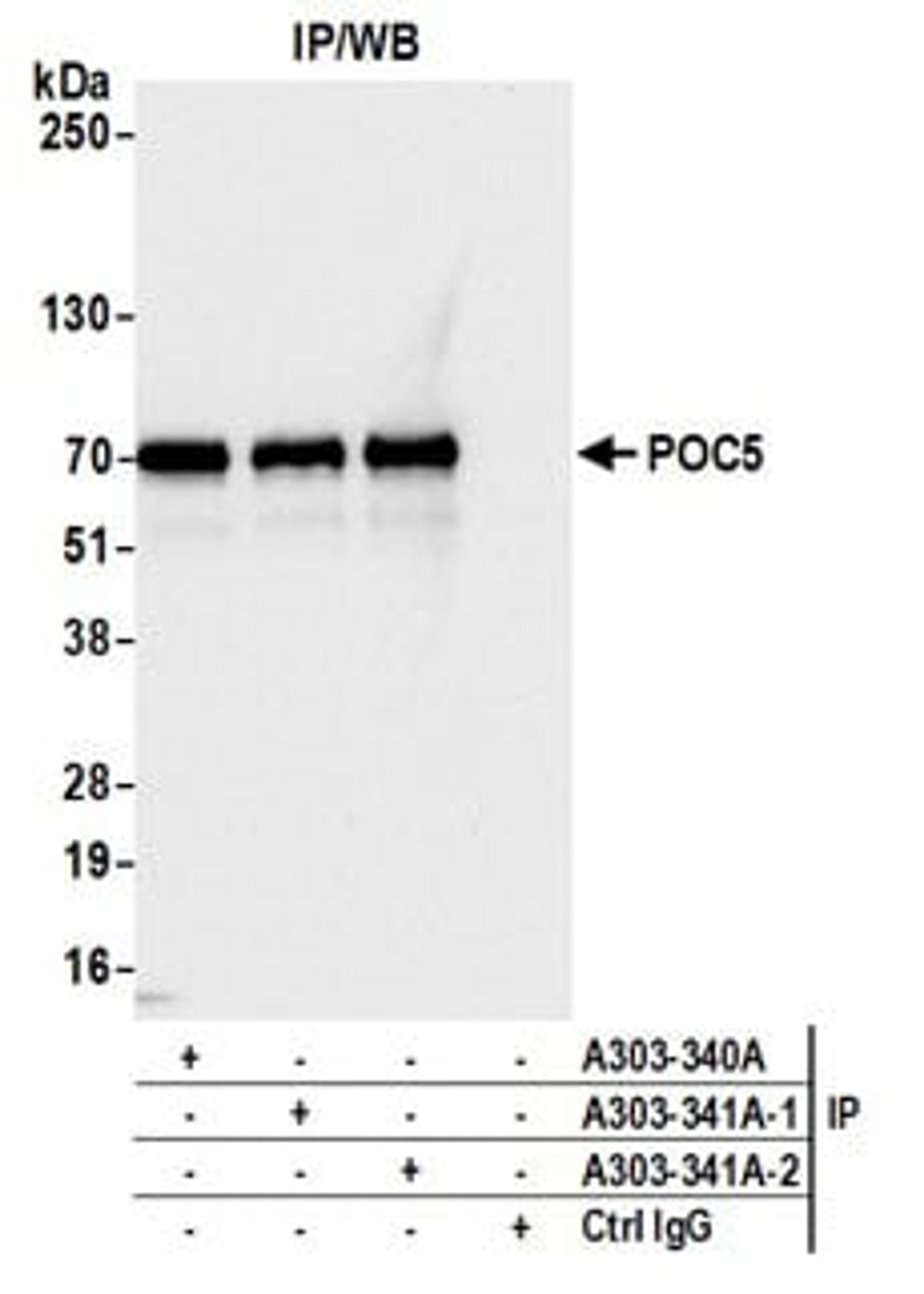 Detection of human POC5 by western blot of immunoprecipitates.