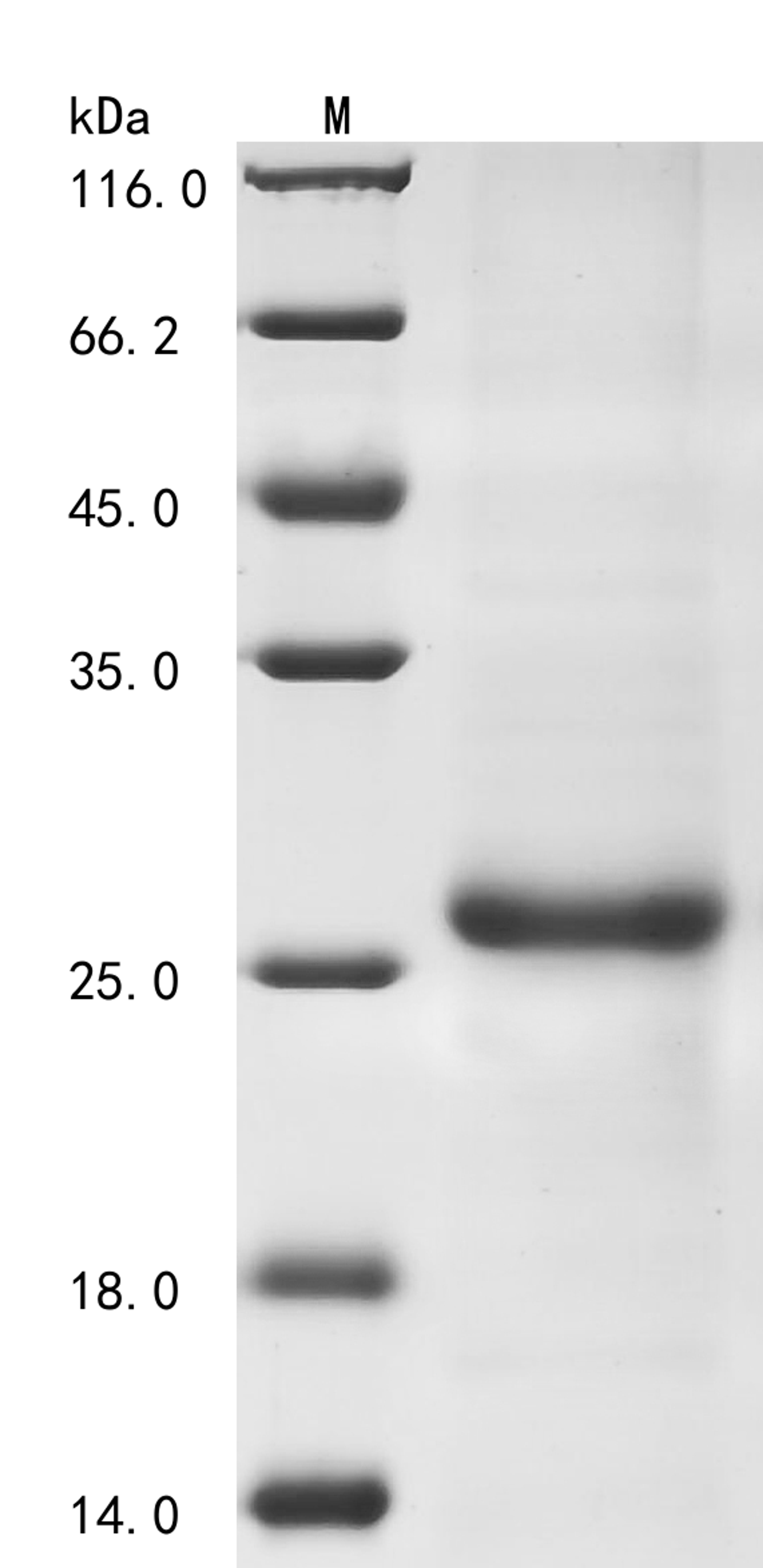 (Tris-Glycine gel) Discontinuous SDS-PAGE (reduced) with 5% enrichment gel and 15% separation gel.