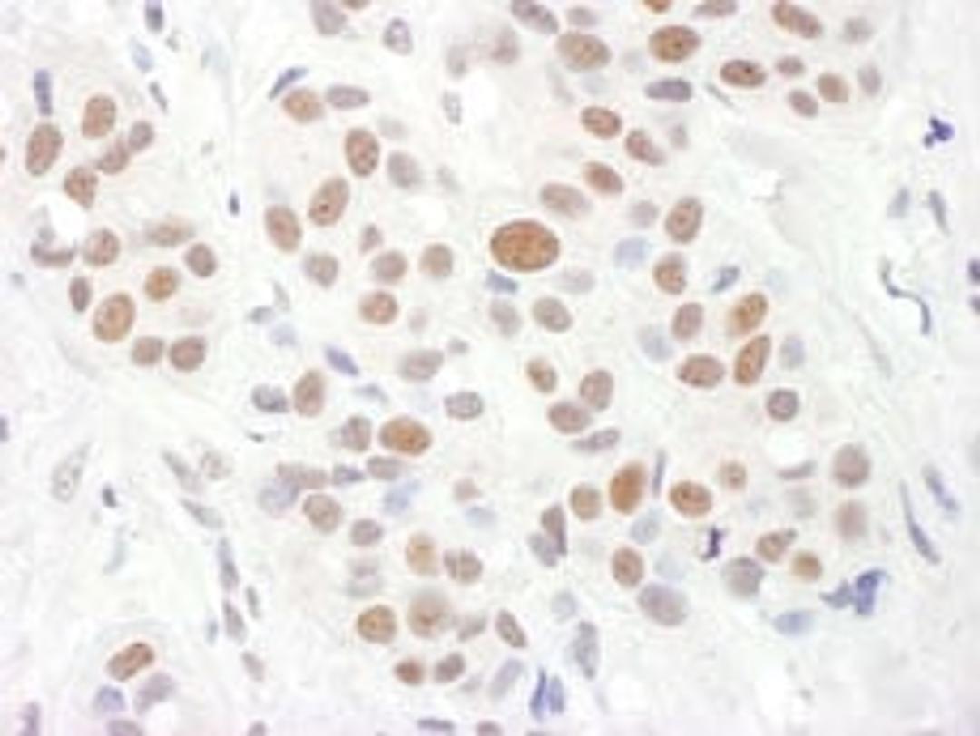 Detection of human RAP1 by immunohistochemistry.