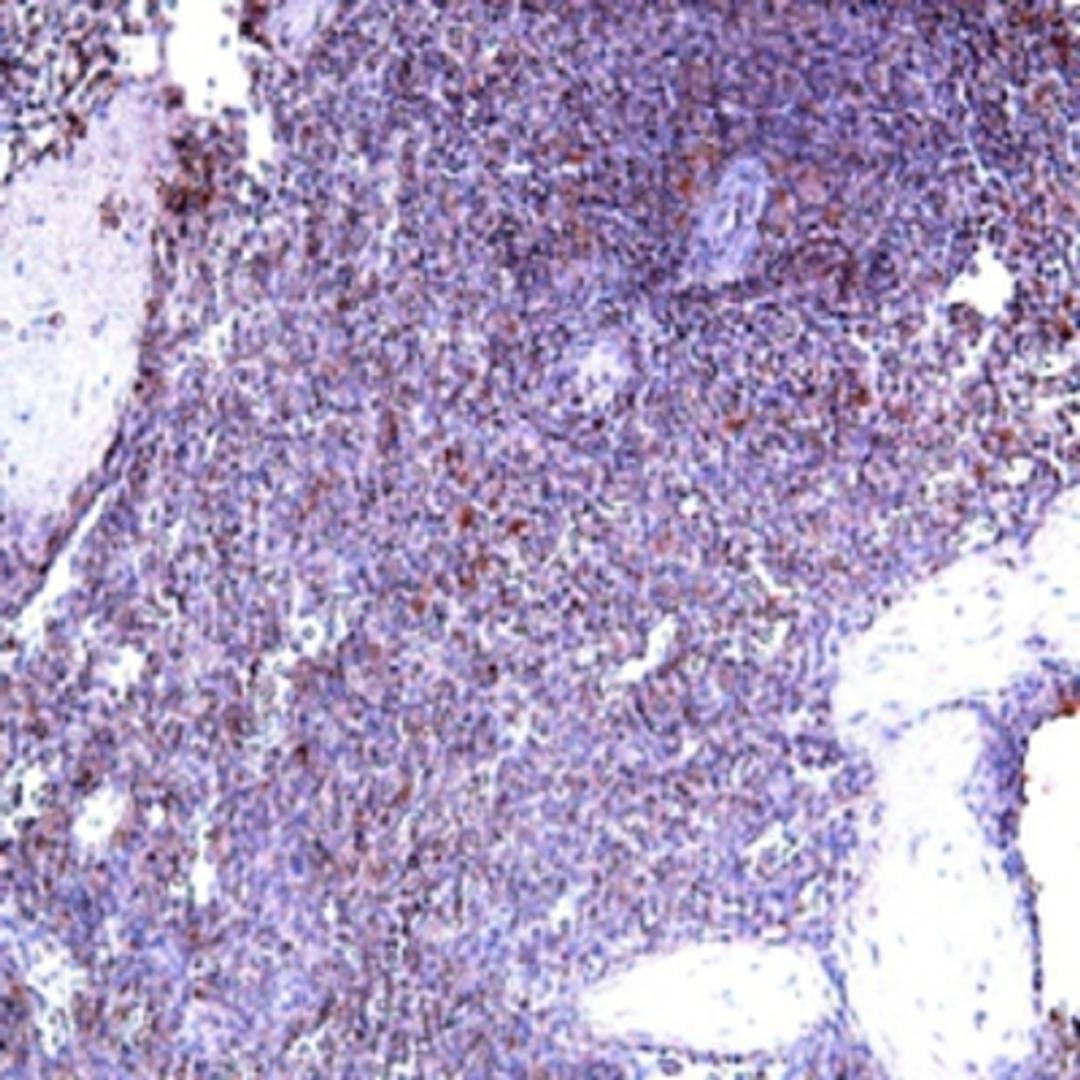 Immunohistochemistry: IL22 RA2 Antibody [NB100-742] - Immunohistochemistry with goat anti-human IL22RA2 on paraffin section of human spleen.