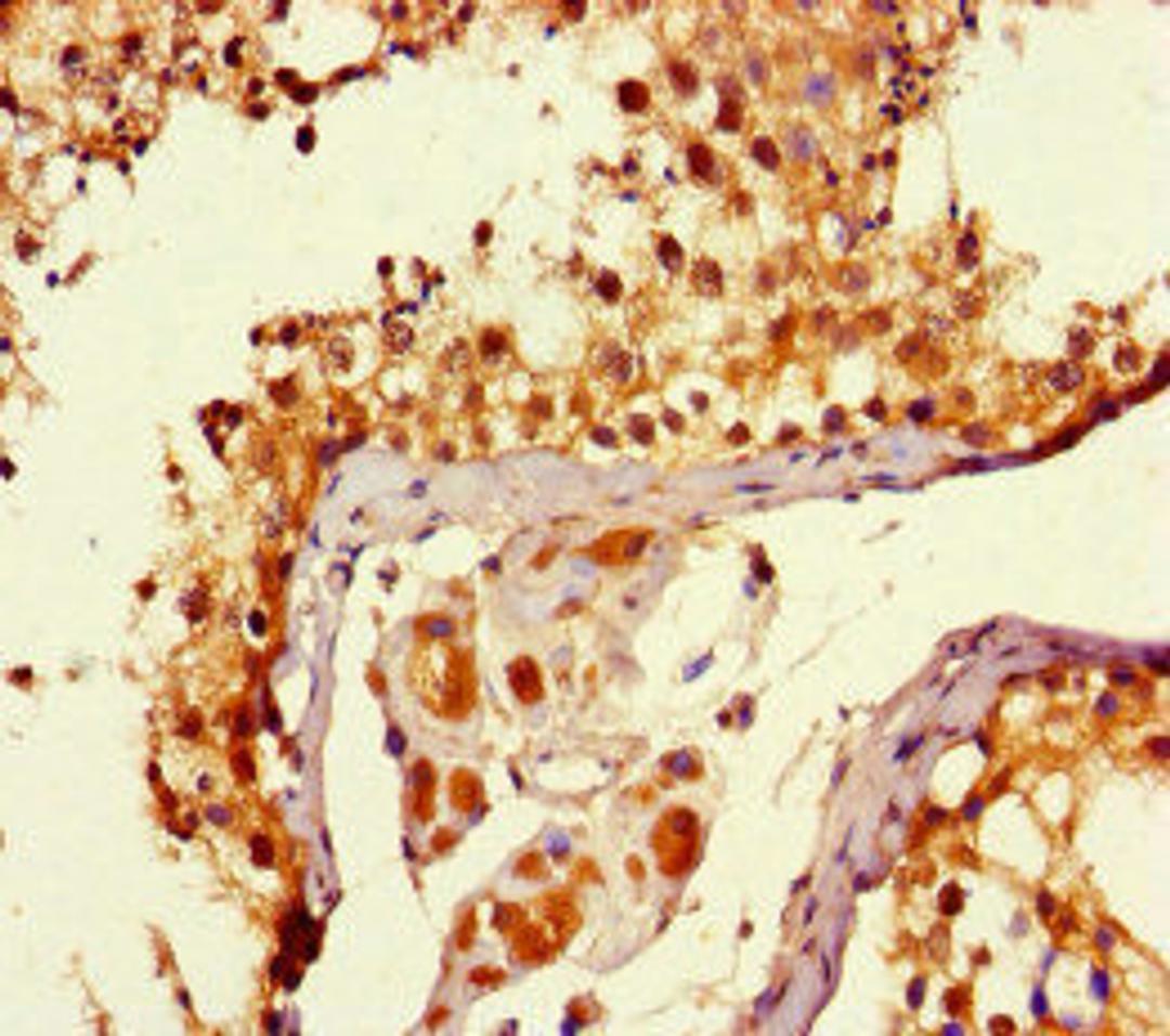 Immunohistochemistry of paraffin-embedded human testis tissue using CSB-PA008968HA01HU at dilution of 1:100