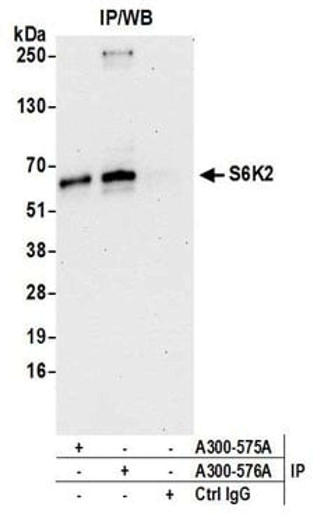 Detection of human S6K2 by western blot of immunoprecipitates.