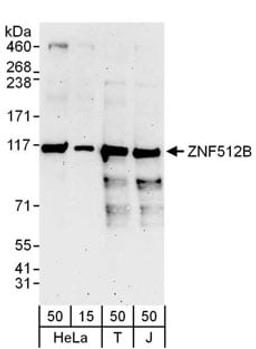 Detection of human ZNF512B by western blot.