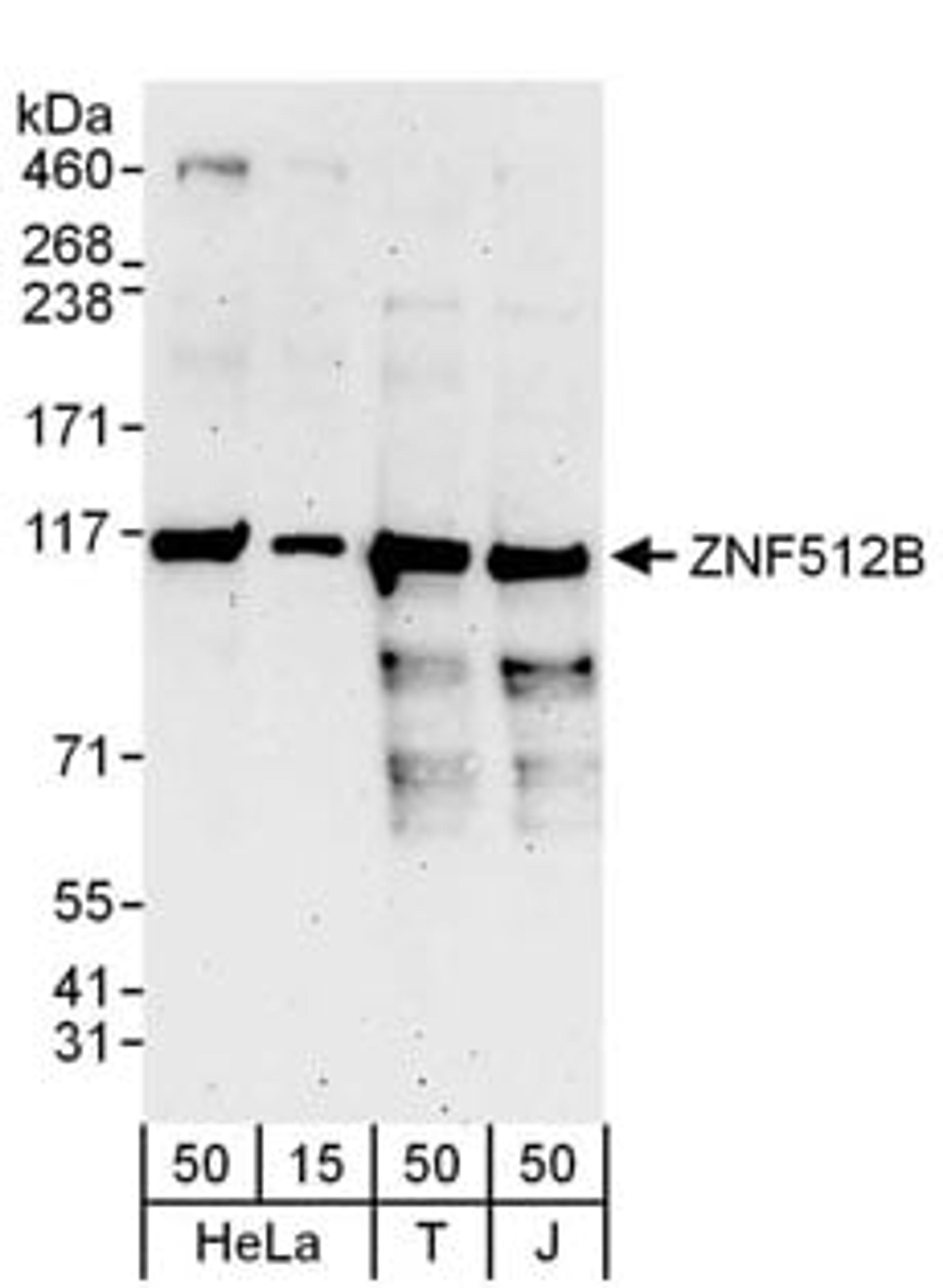 Detection of human ZNF512B by western blot.