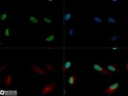 Immunocytochemistry/Immunofluorescence: Jumonji/JARID2 Antibody [NB100-2214] - JARID2 antibody was tested in HeLa cells with Dylight 488 (green). Nuclei and alpha-tubulin were counterstained with DAPI (blue) and Dylight 550 (red).