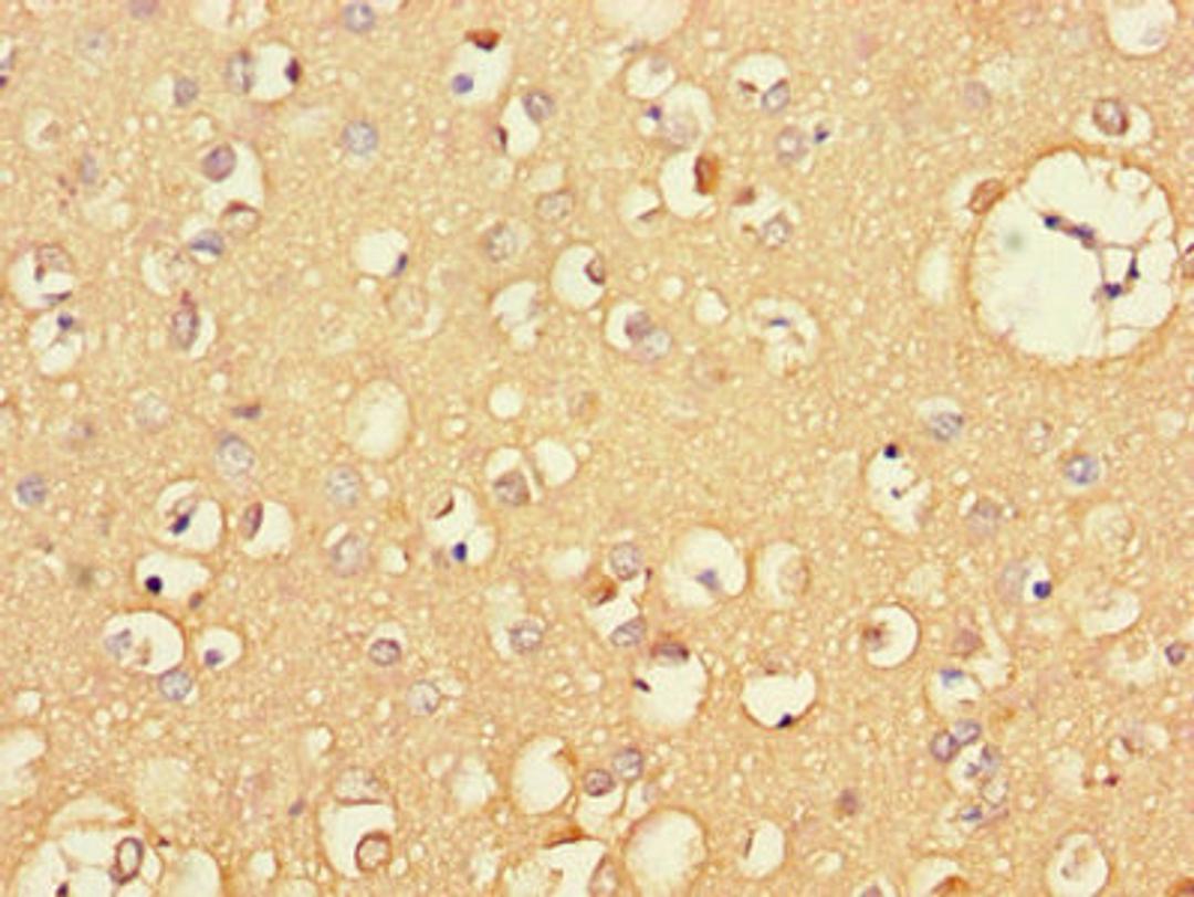 Immunohistochemistry of paraffin-embedded human brain tissue using CSB-PA06119A0Rb at dilution of 1:100