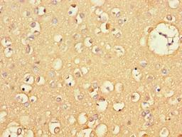 Immunohistochemistry of paraffin-embedded human brain tissue using CSB-PA06119A0Rb at dilution of 1:100