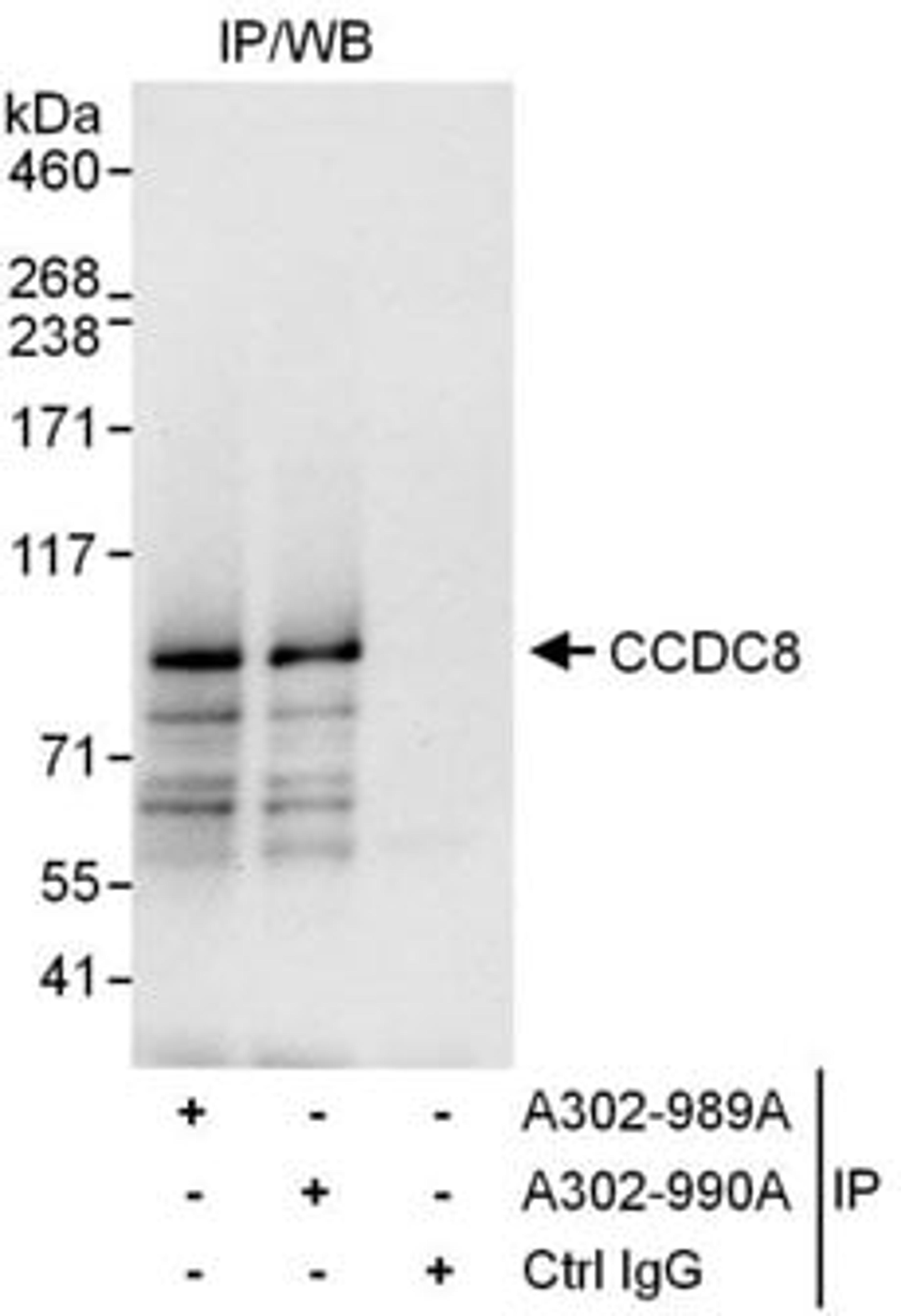 Detection of human CCDC8 by western blot of immunoprecipitates.