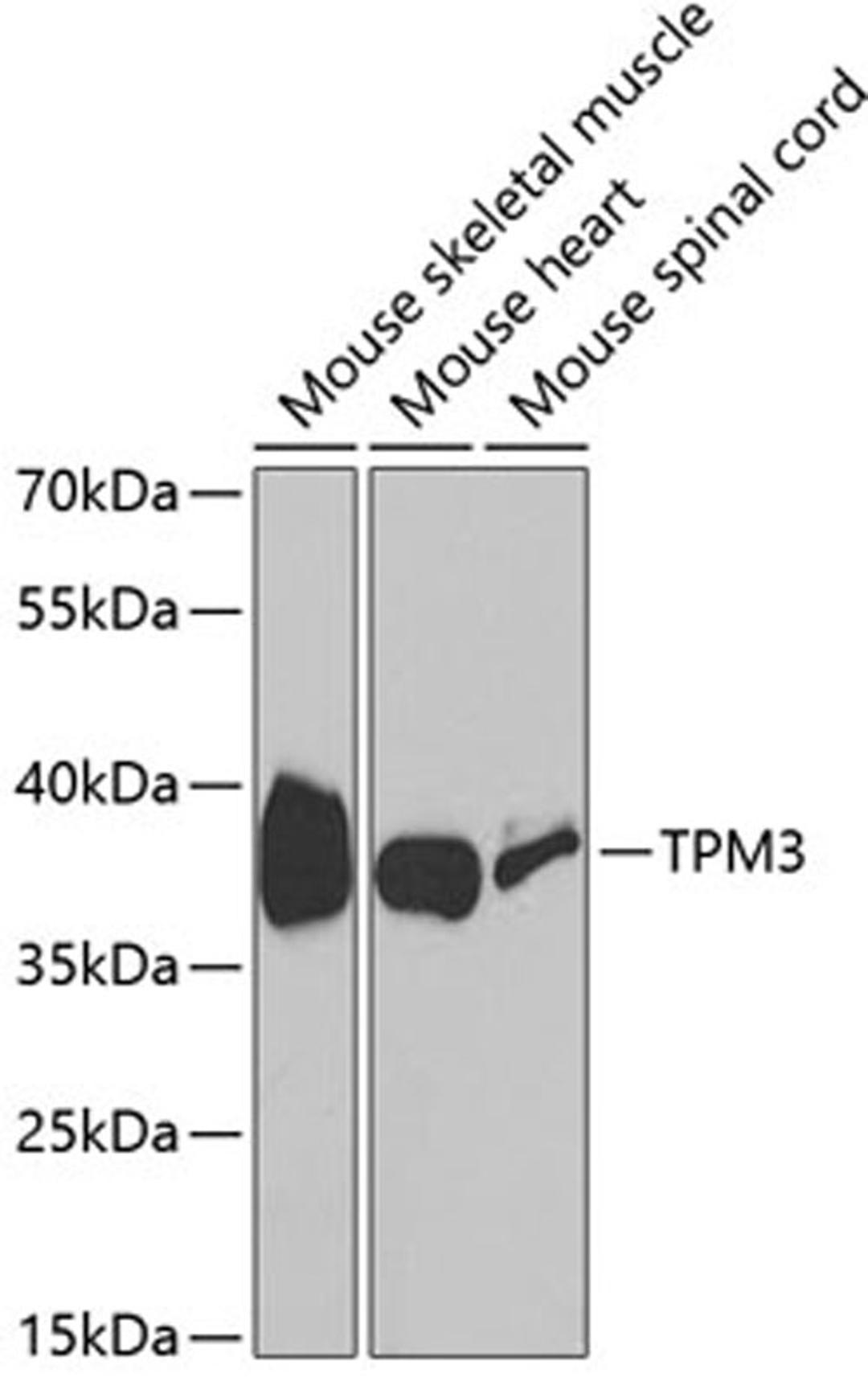 Western blot - TPM3 antibody (A1206)