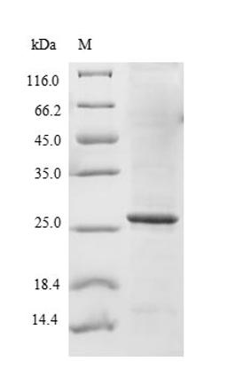 (Tris-Glycine gel) Discontinuous SDS-PAGE (reduced) with 5% enrichment gel and 15% separation gel.