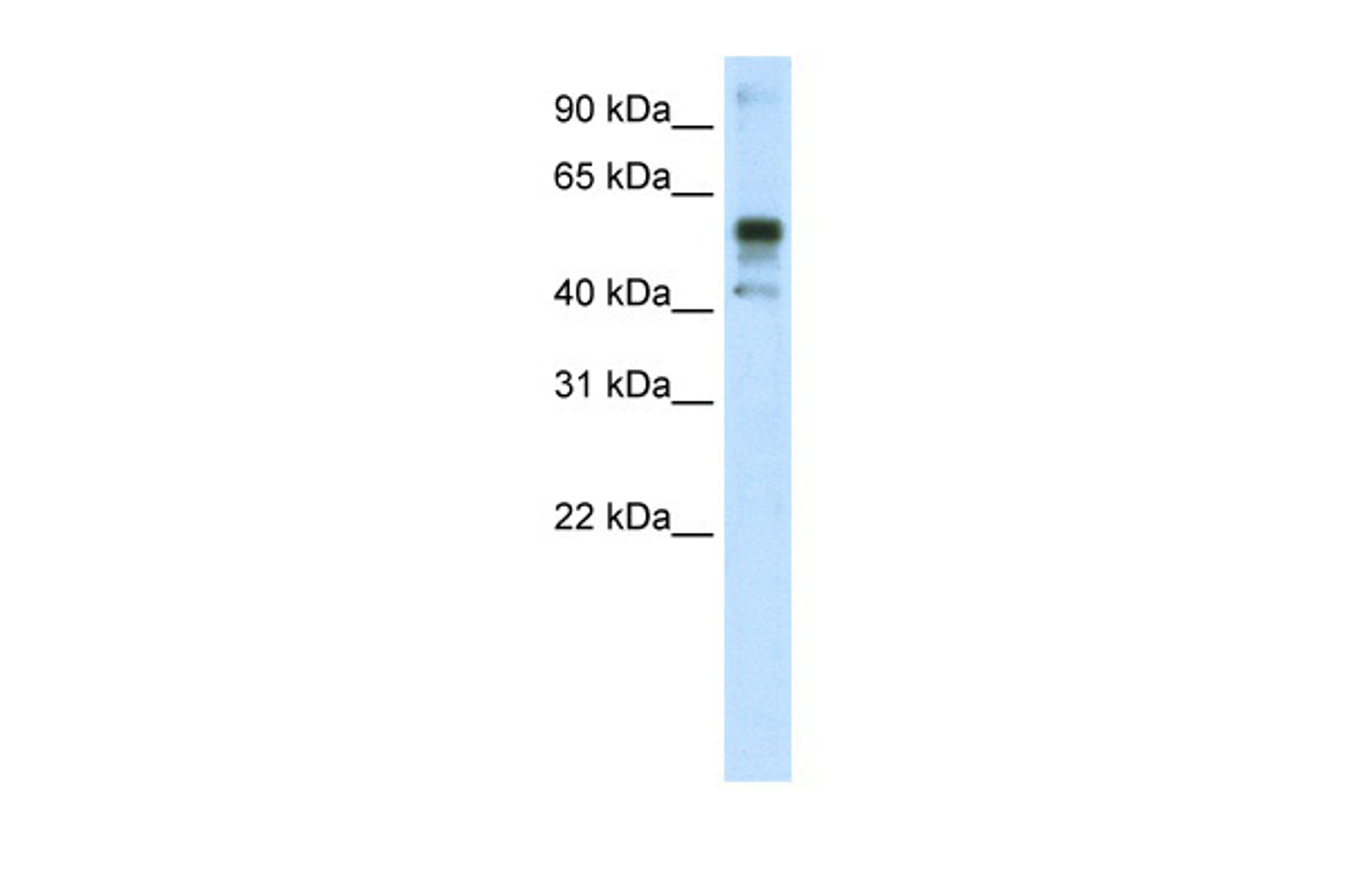 Antibody used in WB on Human A172 at 1.25 ug/ml.