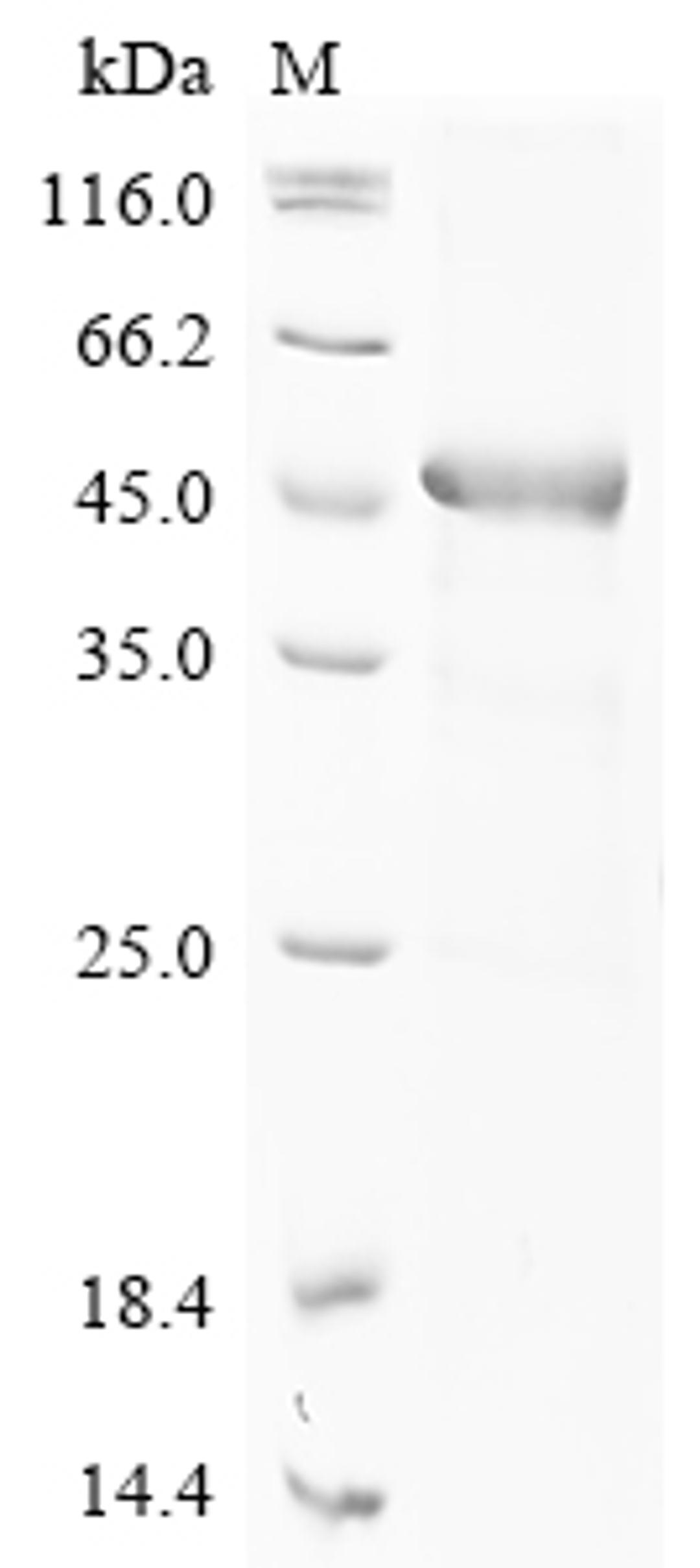 (Tris-Glycine gel) Discontinuous SDS-PAGE (reduced) with 5% enrichment gel and 15% separation gel.