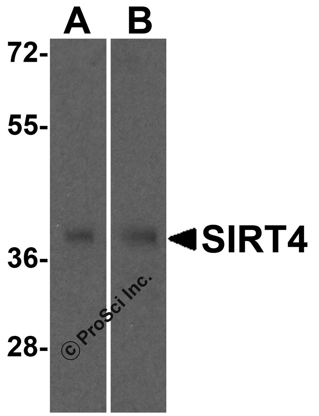 Western blot analysis of SIRT4 in (A) human and (B) mouse liver tissue lysate with SIRT4 antibody at 0.5 &#956;g/mL