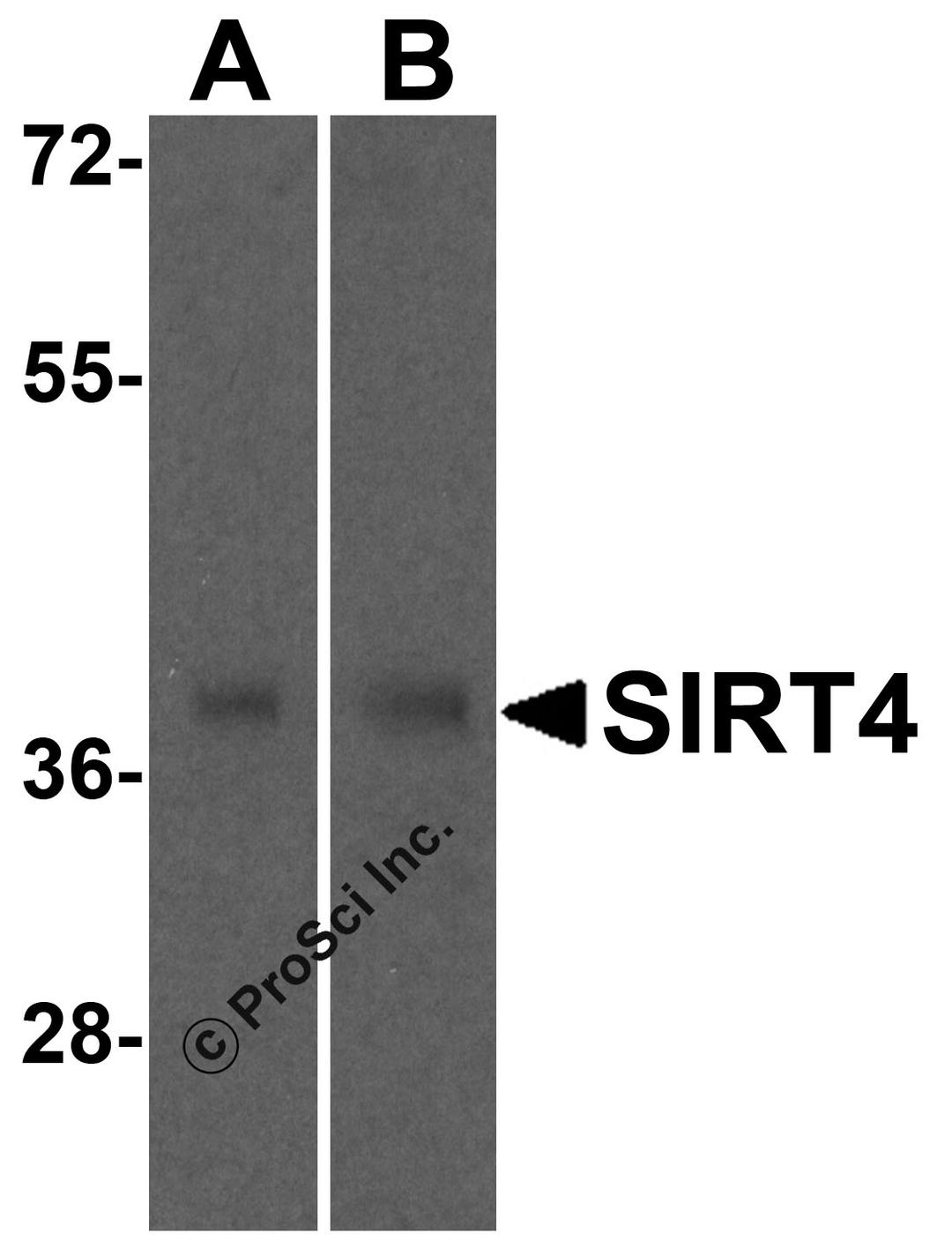 Western blot analysis of SIRT4 in (A) human and (B) mouse liver tissue lysate with SIRT4 antibody at 0.5 μg/mL
