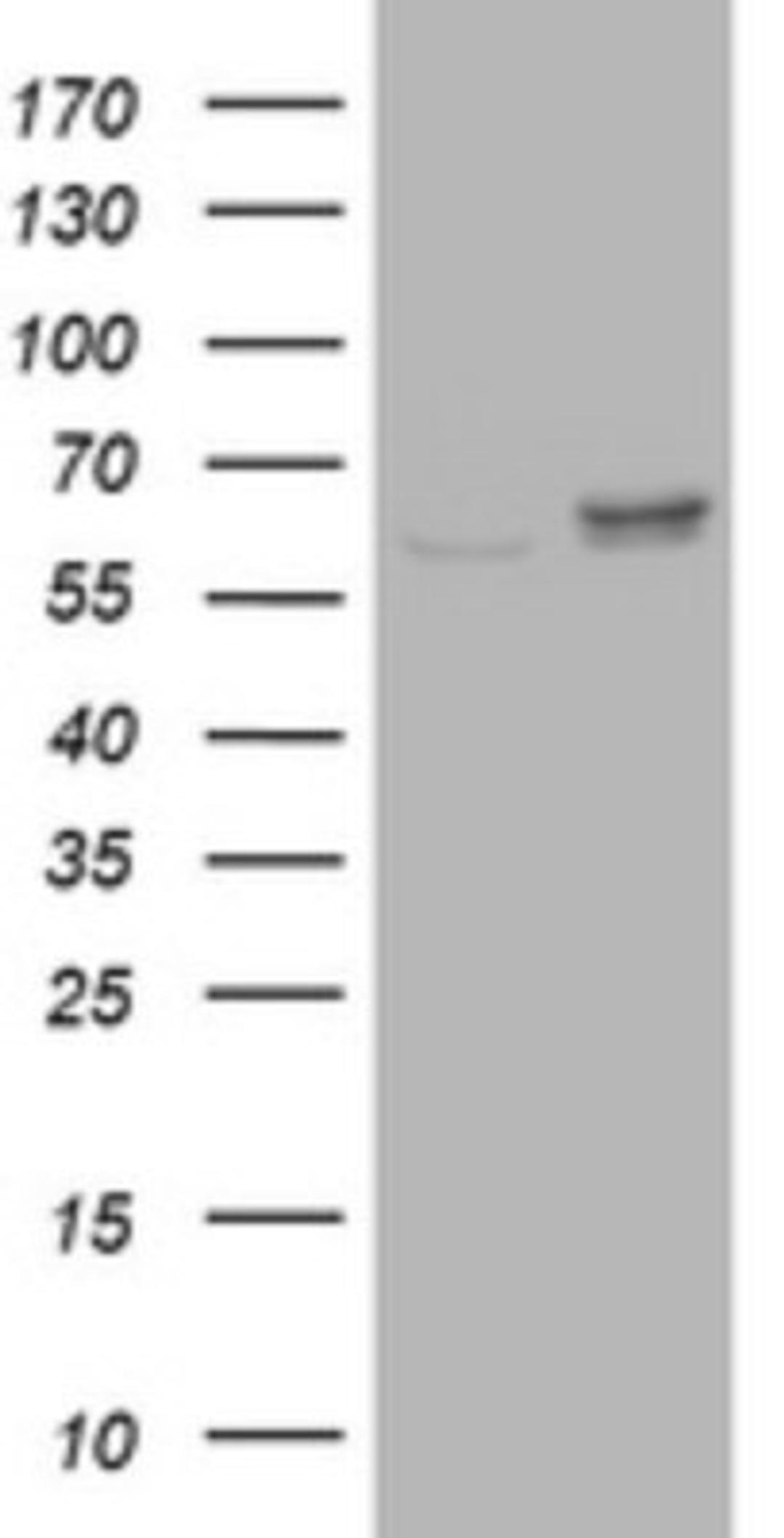 Western Blot: Ribophorin II Antibody (1G9) [NBP2-45963] - Analysis of HEK293T cells were transfected with the pCMV6-ENTRY control (Left lane) or pCMV6-ENTRY Ribophorin II.