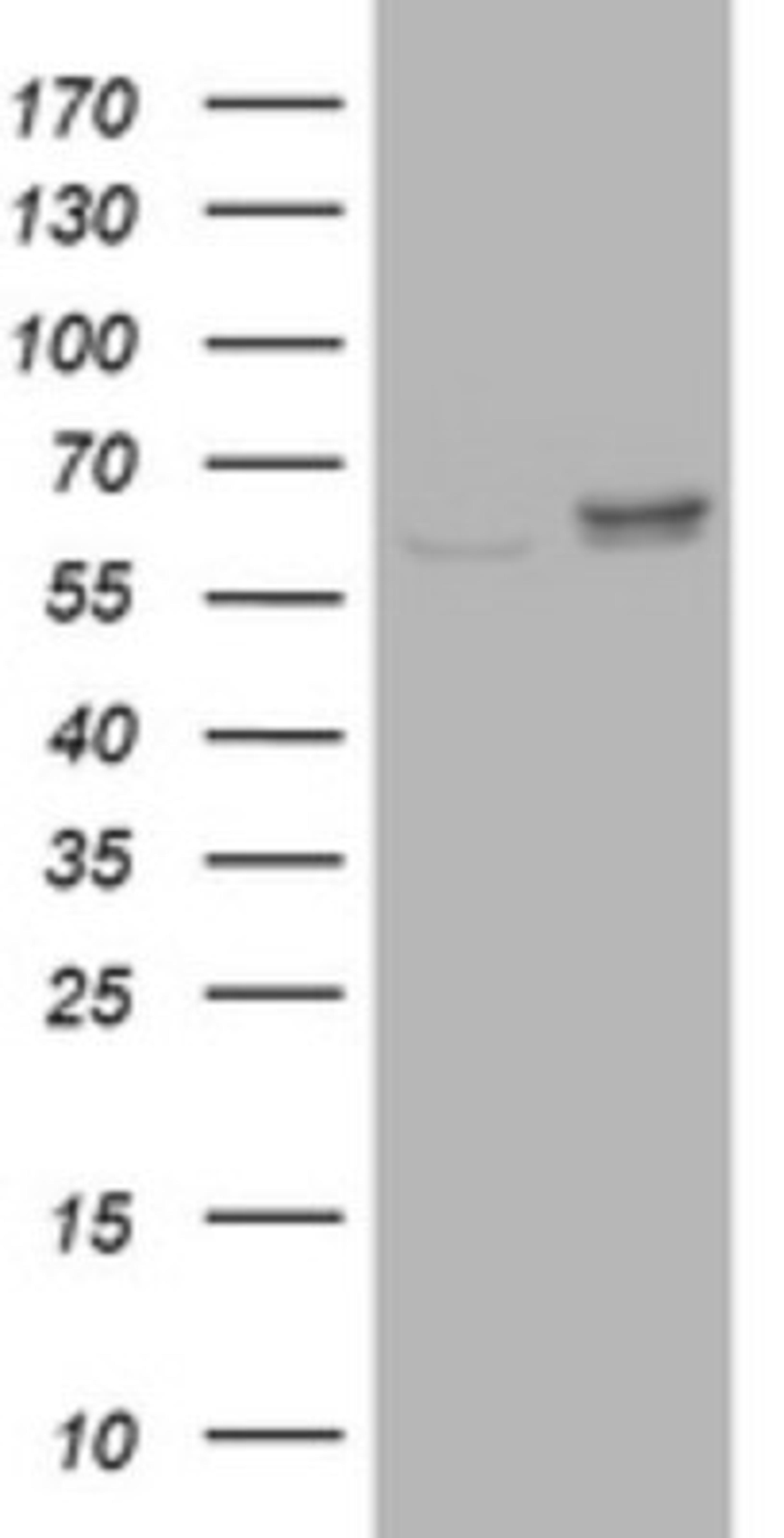 Western Blot: Ribophorin II Antibody (1G9) [NBP2-45963] - Analysis of HEK293T cells were transfected with the pCMV6-ENTRY control (Left lane) or pCMV6-ENTRY Ribophorin II.