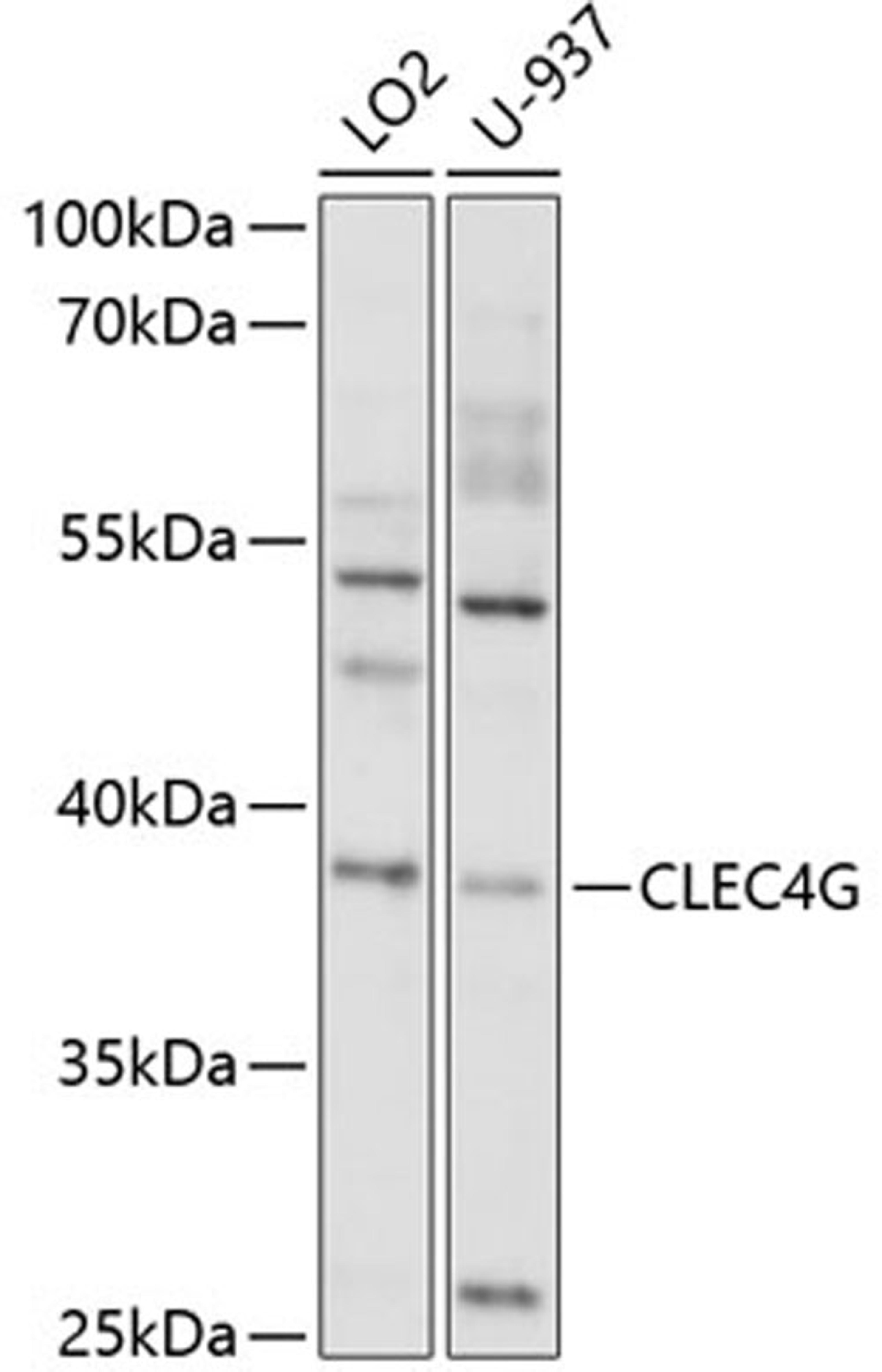 Western blot - CLEC4G antibody (A10500)