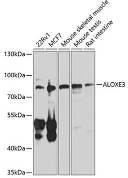 Western blot - ALOXE3 antibody (A8245)