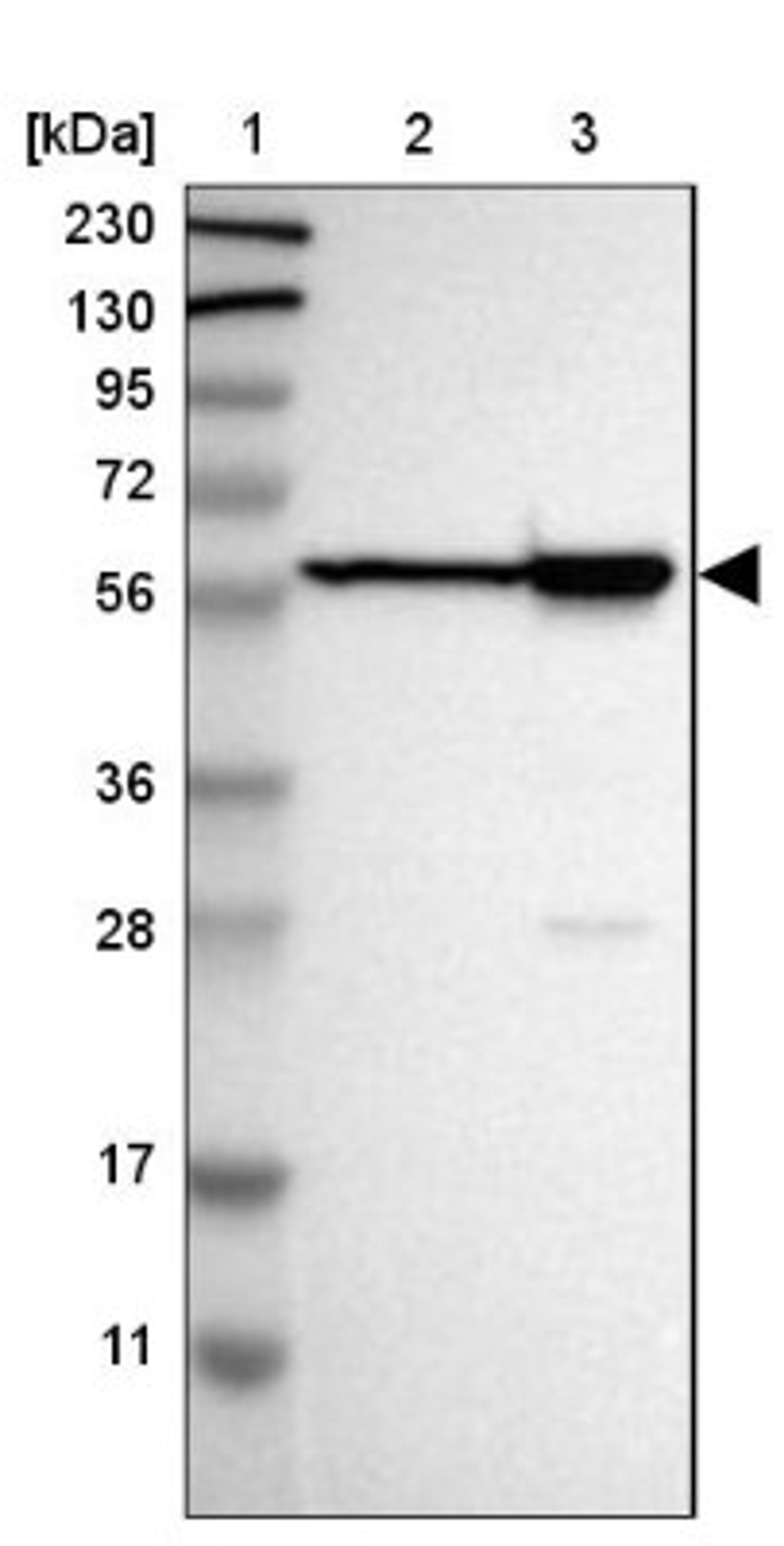 Western Blot: LAP2 Antibody [NBP1-87822] - Lane 1: Marker [kDa] 230, 130, 95, 72, 56, 36, 28, 17, 11<br/>Lane 2: Human cell line RT-4<br/>Lane 3: Human cell line U-251MG sp