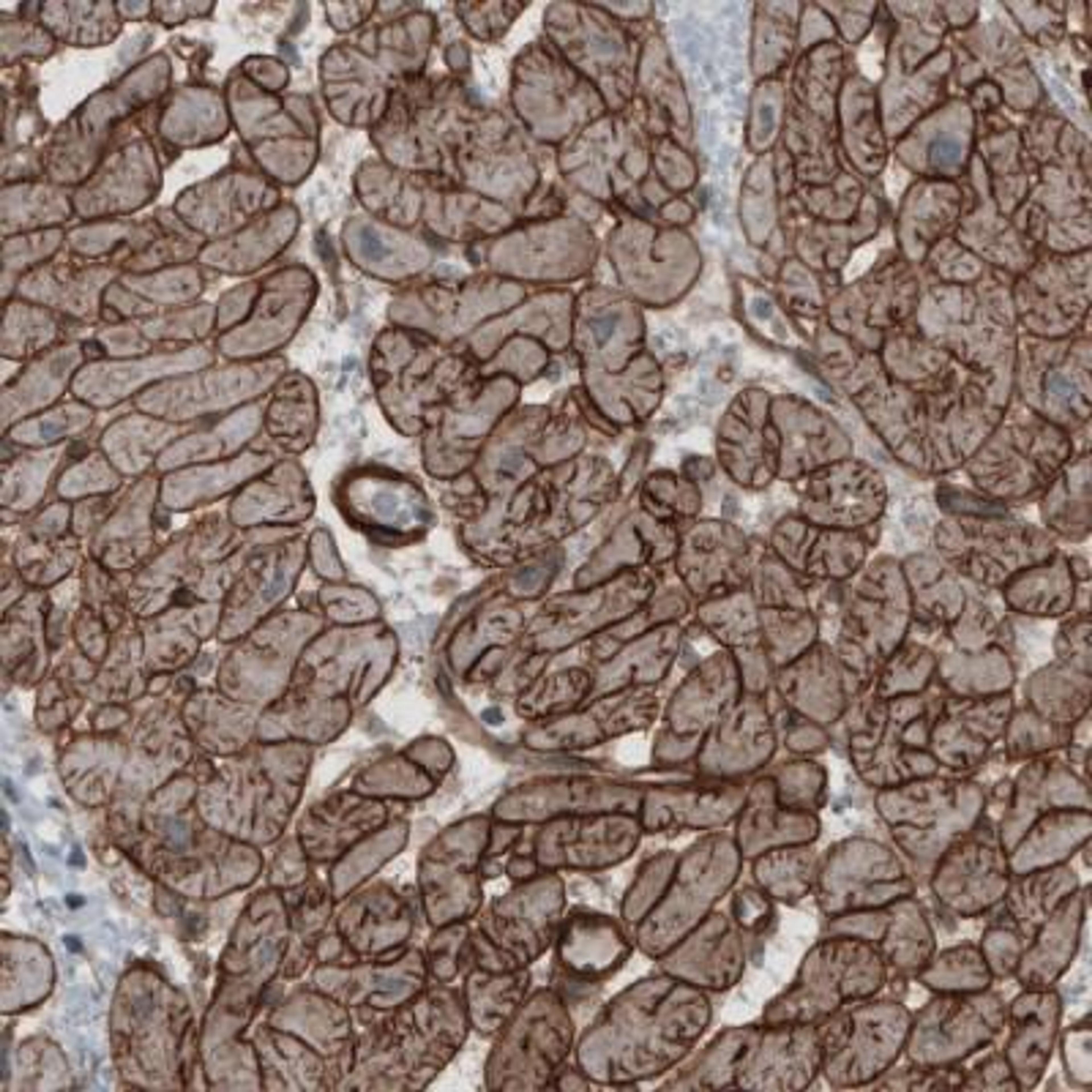 Immunohistochemistry: Laminin S/Laminin beta 2 Antibody (CL2976) [NBP2-42386] - Staining of human heart shows strong membranous immunoreactivity in cardiomyocytes.