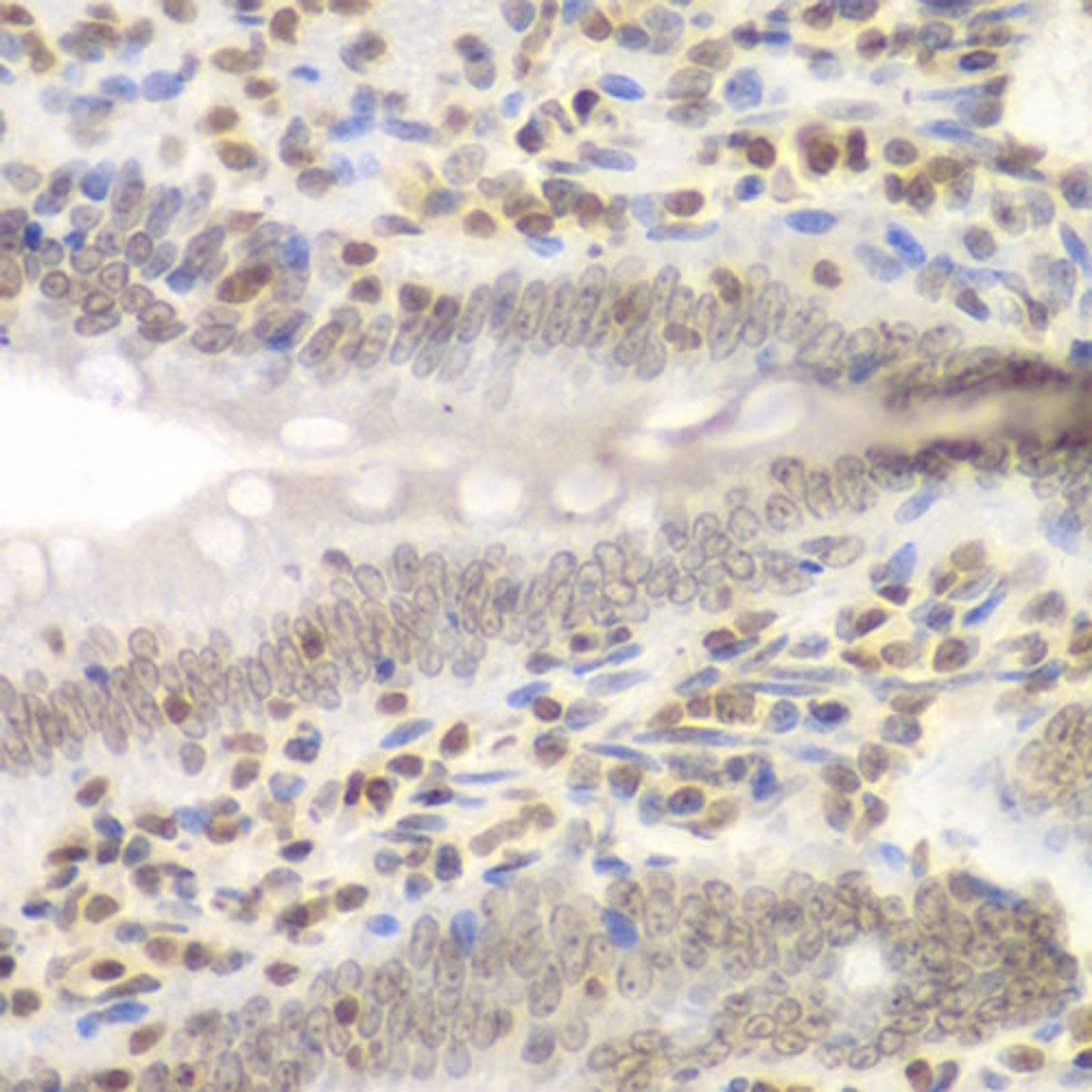 Immunohistochemistry  - UHRF2 antibody (A13602)