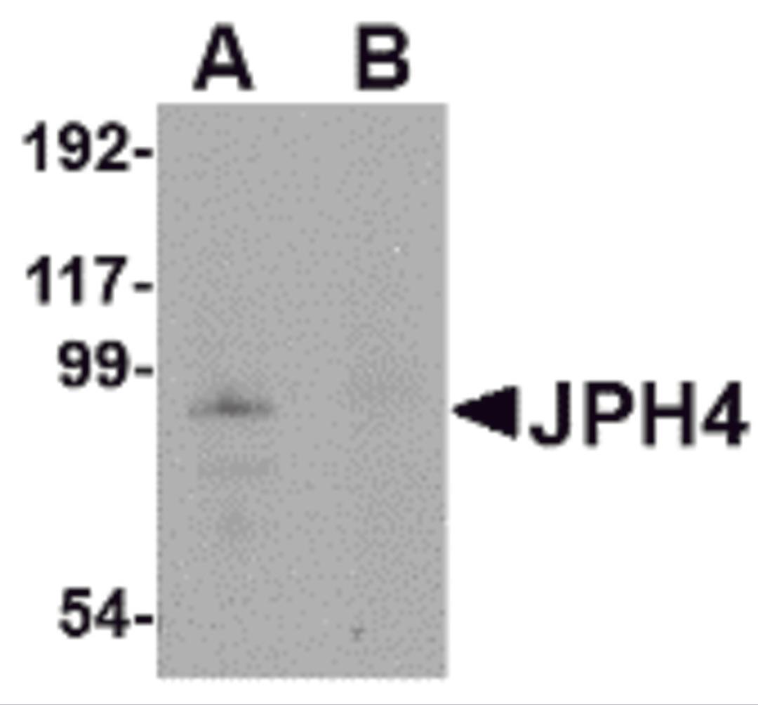 Western blot analysis of JPH4 in mouse brain tissue lysate with JPH4 antibody at 1 &#956;g/mL in (A) the absence and (B) the presence of blocking peptide.