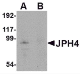 Western blot analysis of JPH4 in mouse brain tissue lysate with JPH4 antibody at 1 &#956;g/mL in (A) the absence and (B) the presence of blocking peptide.