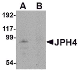 Western blot analysis of JPH4 in mouse brain tissue lysate with JPH4 antibody at 1 μg/mL in (A) the absence and (B) the presence of blocking peptide.
