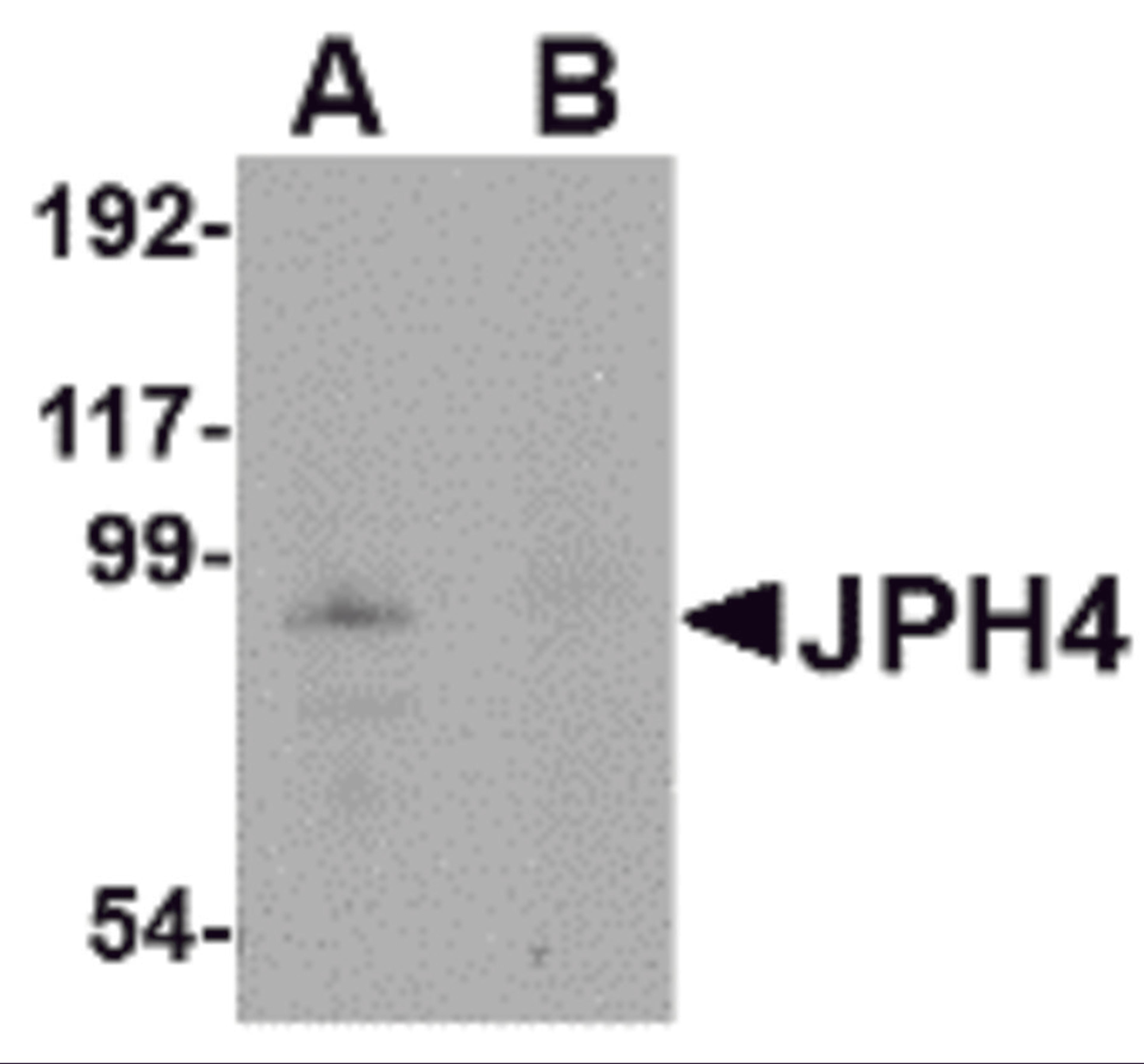 Western blot analysis of JPH4 in mouse brain tissue lysate with JPH4 antibody at 1 μg/mL in (A) the absence and (B) the presence of blocking peptide.