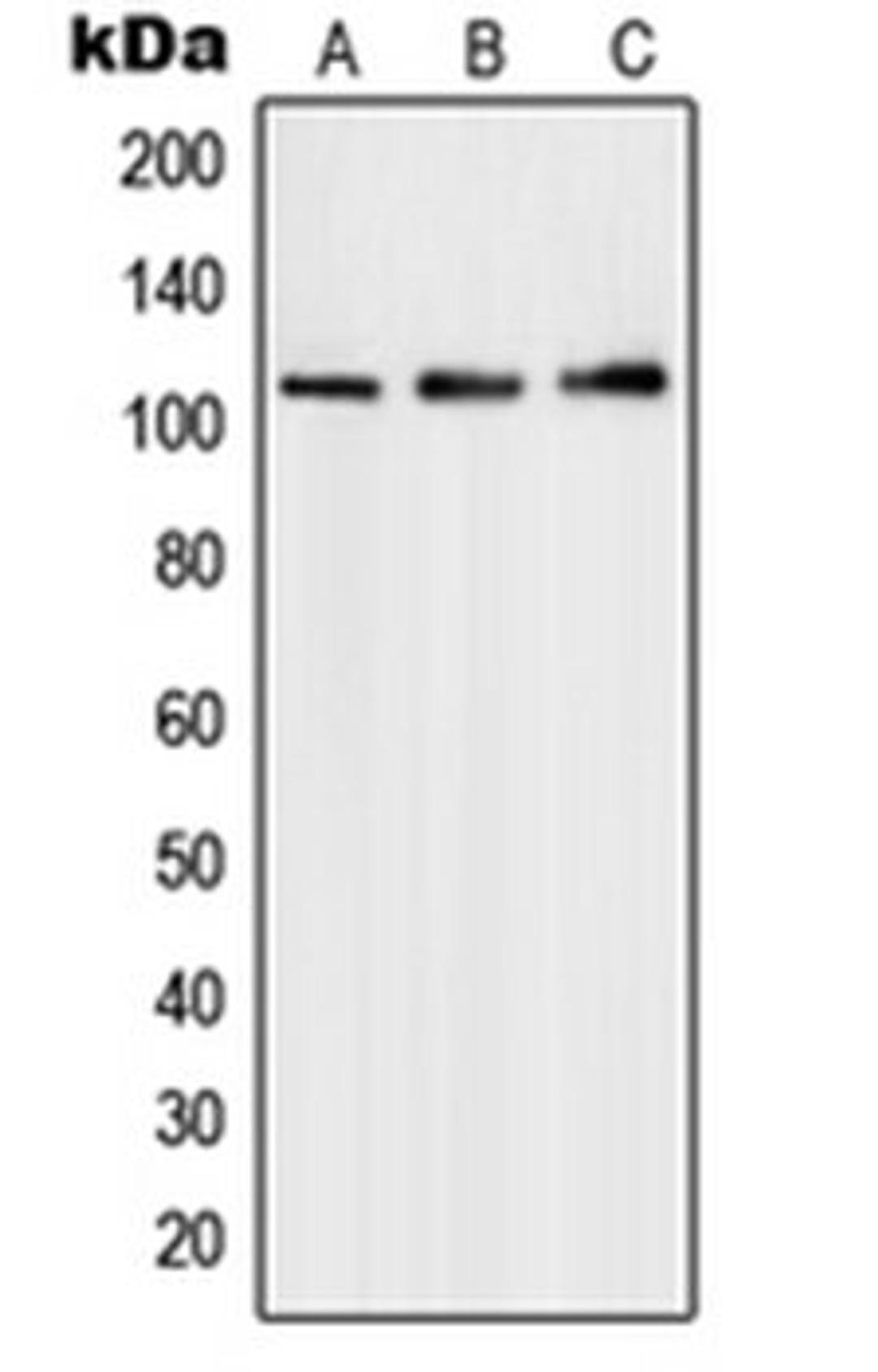 Western blot analysis of HepG2 (Lane 1), Molt4 (Lane 2), A549 (Lane 3) whole cell lysates using PMS1 antibody