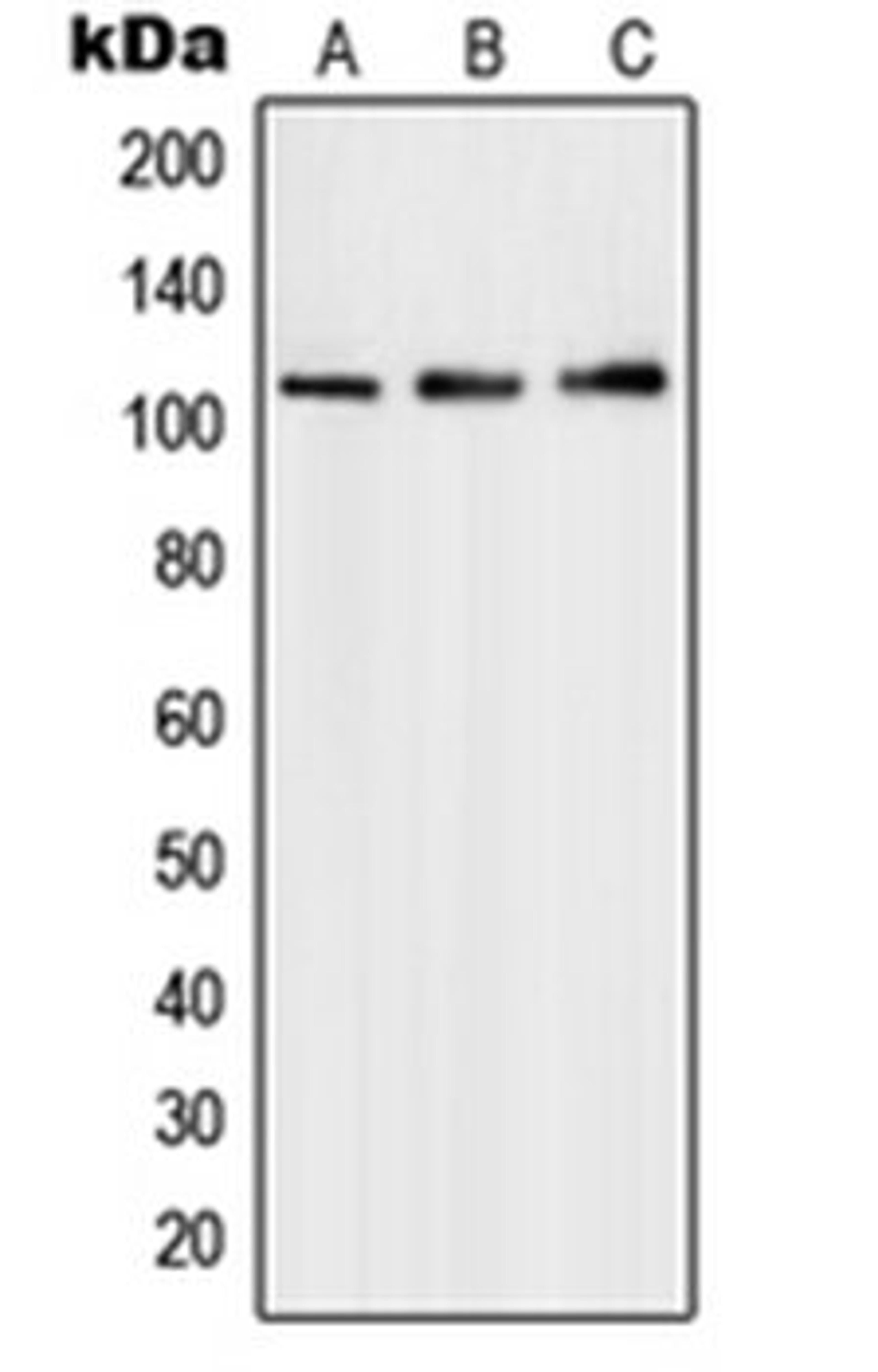 Western blot analysis of HepG2 (Lane 1), Molt4 (Lane 2), A549 (Lane 3) whole cell lysates using PMS1 antibody