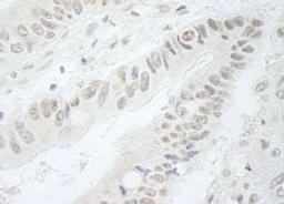 Detection of human RFC3 by immunohistochemistry.