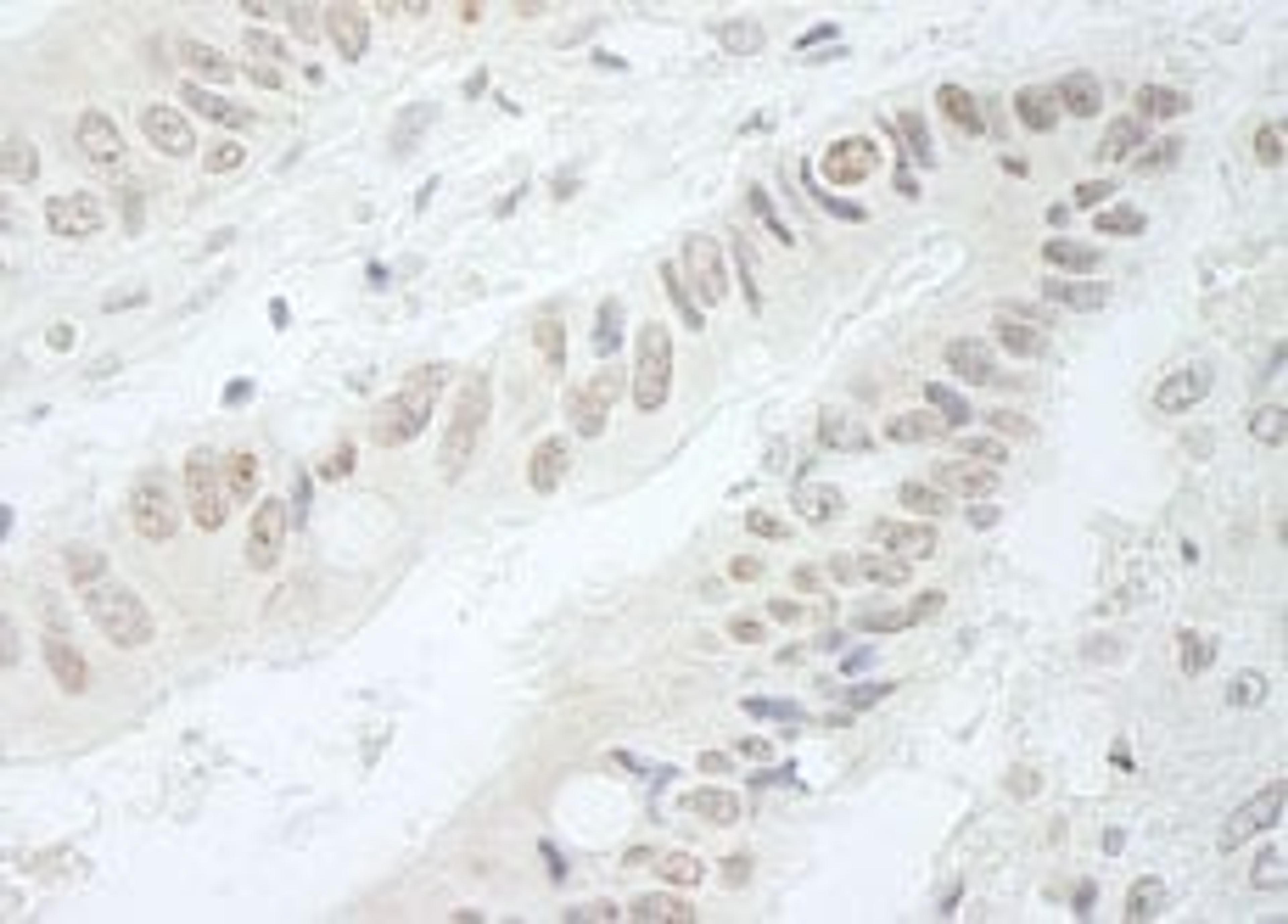 Detection of human RFC3 by immunohistochemistry.