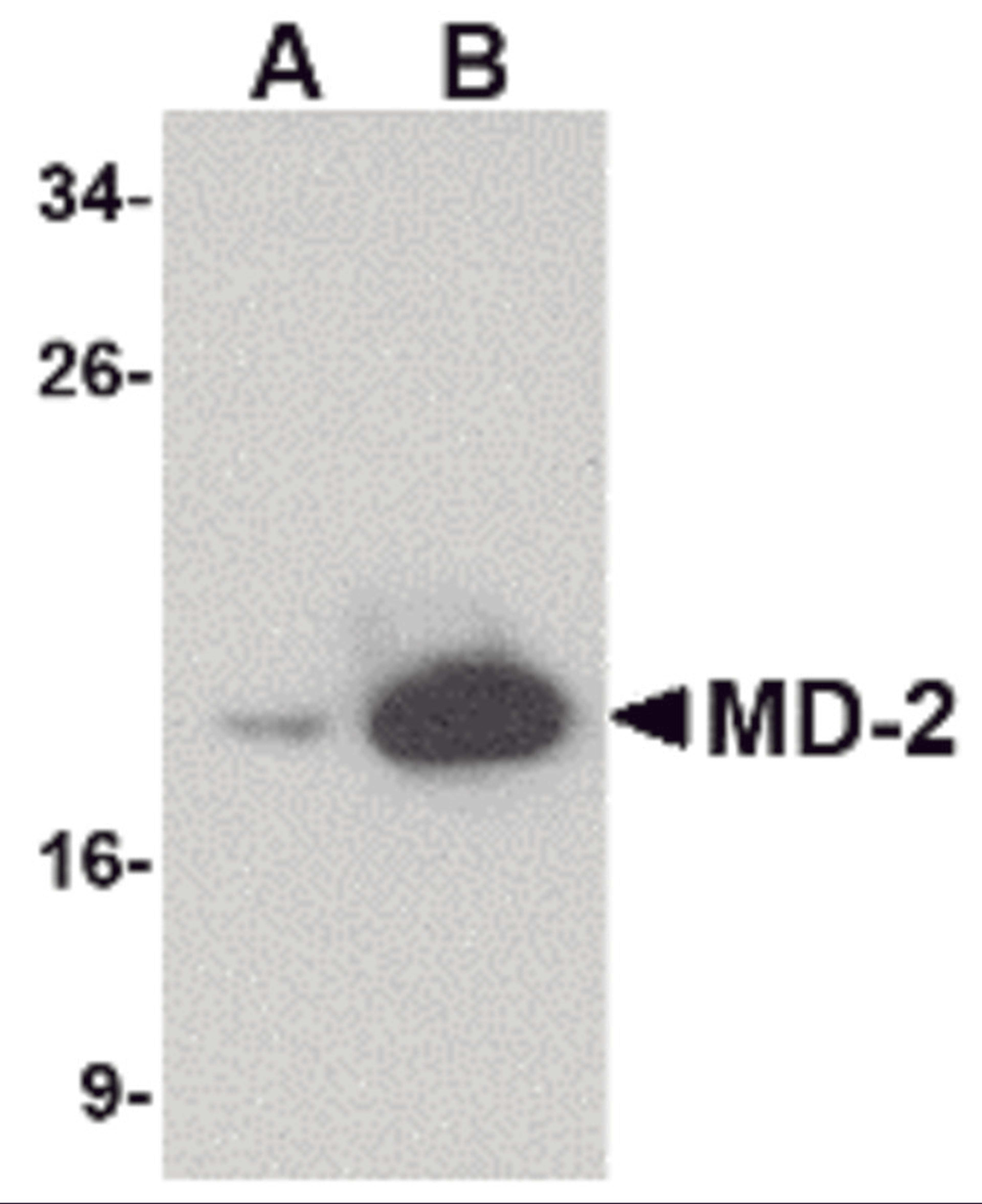 Western blot analysis of (A) 25 and (B) 125 ng of MD-2 recombinant protein with MD-2 antibody at 1 &#956;g/mL.