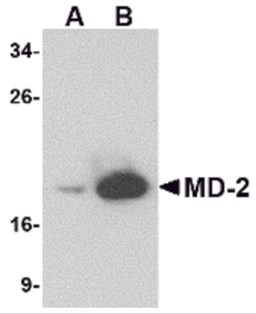Western blot analysis of (A) 25 and (B) 125 ng of MD-2 recombinant protein with MD-2 antibody at 1 μg/mL.