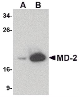 Western blot analysis of (A) 25 and (B) 125 ng of MD-2 recombinant protein with MD-2 antibody at 1 μg/mL.