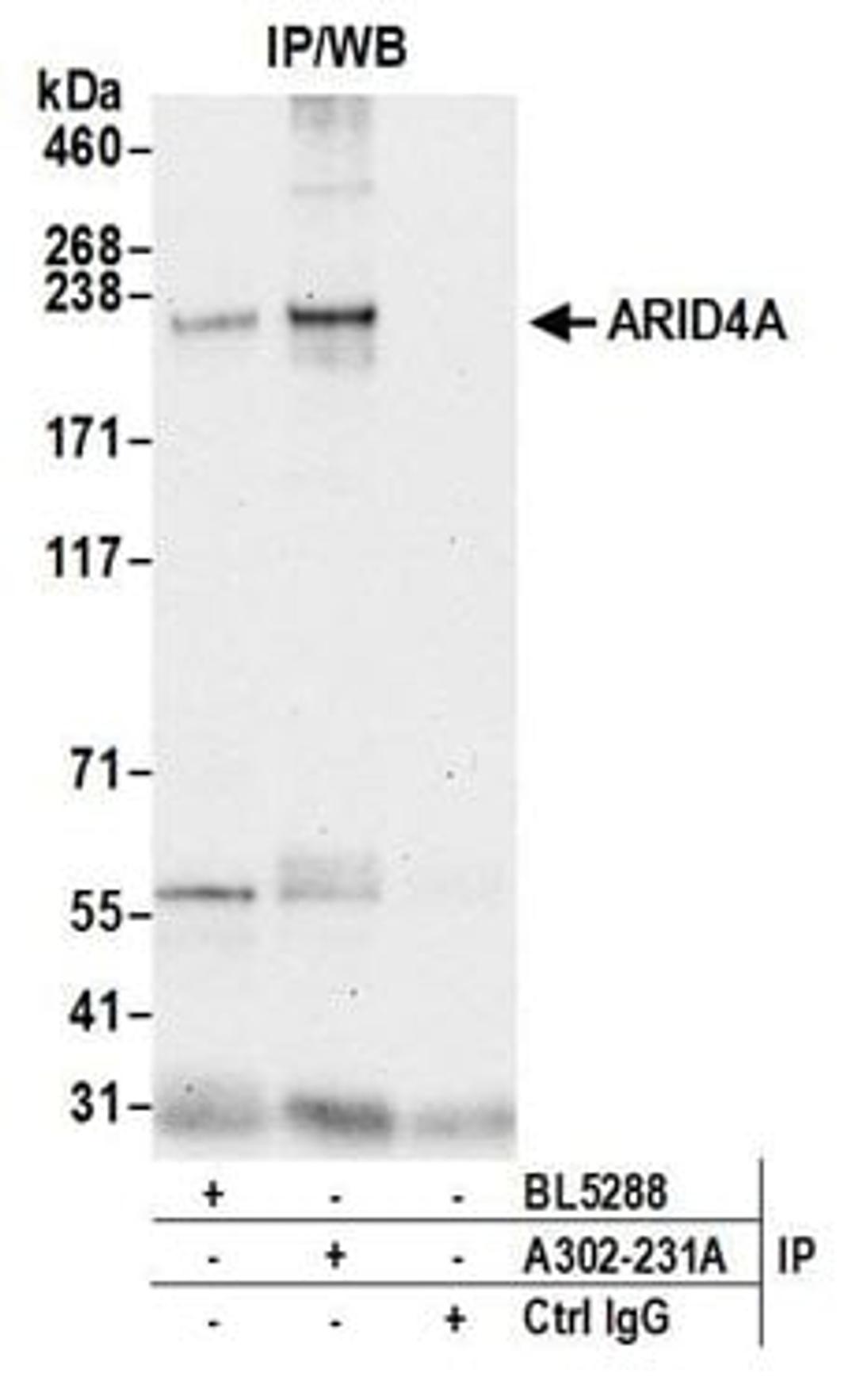 Detection of human ARID4A by western blot of immunoprecipitates.